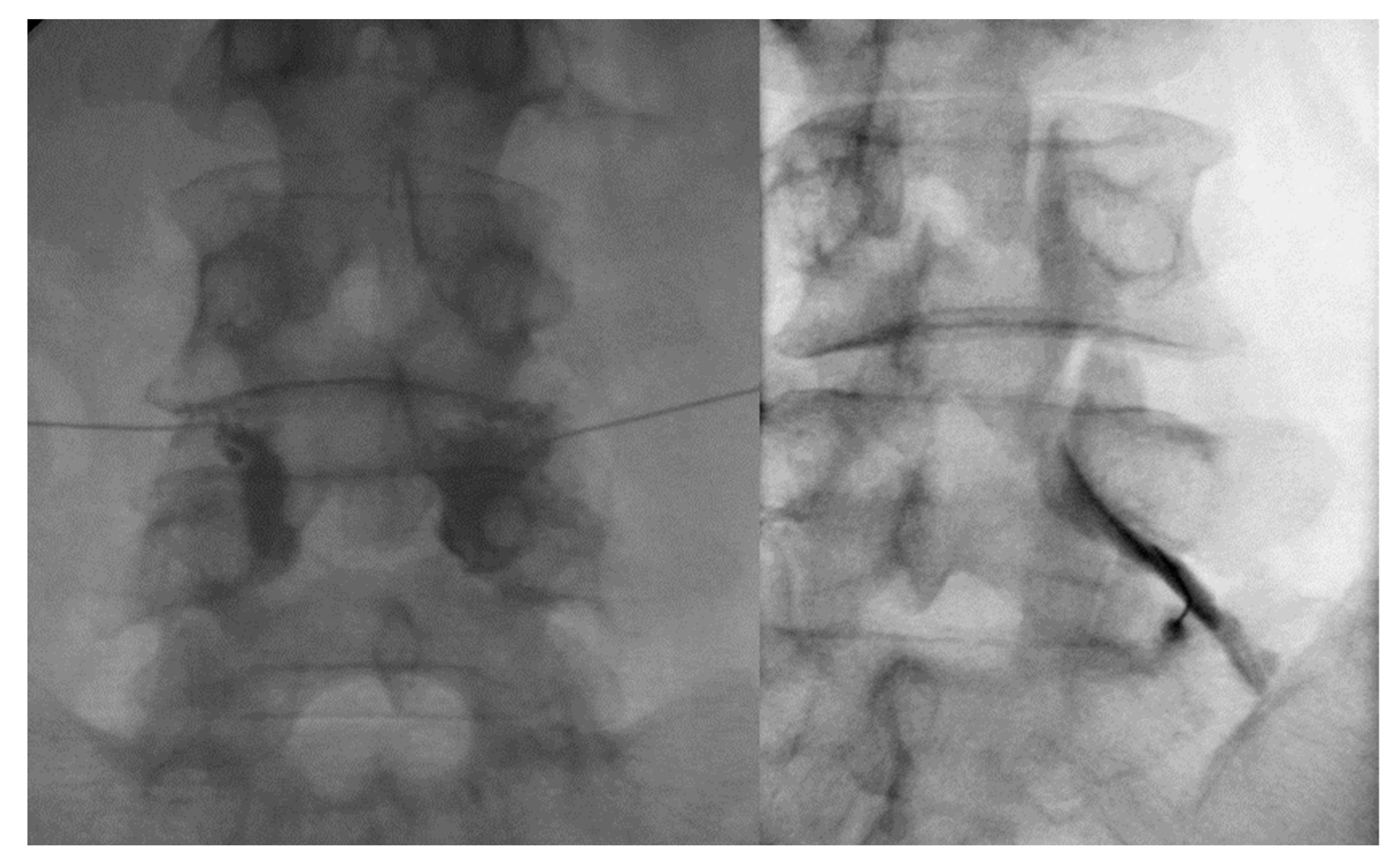 Toxins 15 00011 g004 Toxins 15 00011 g004