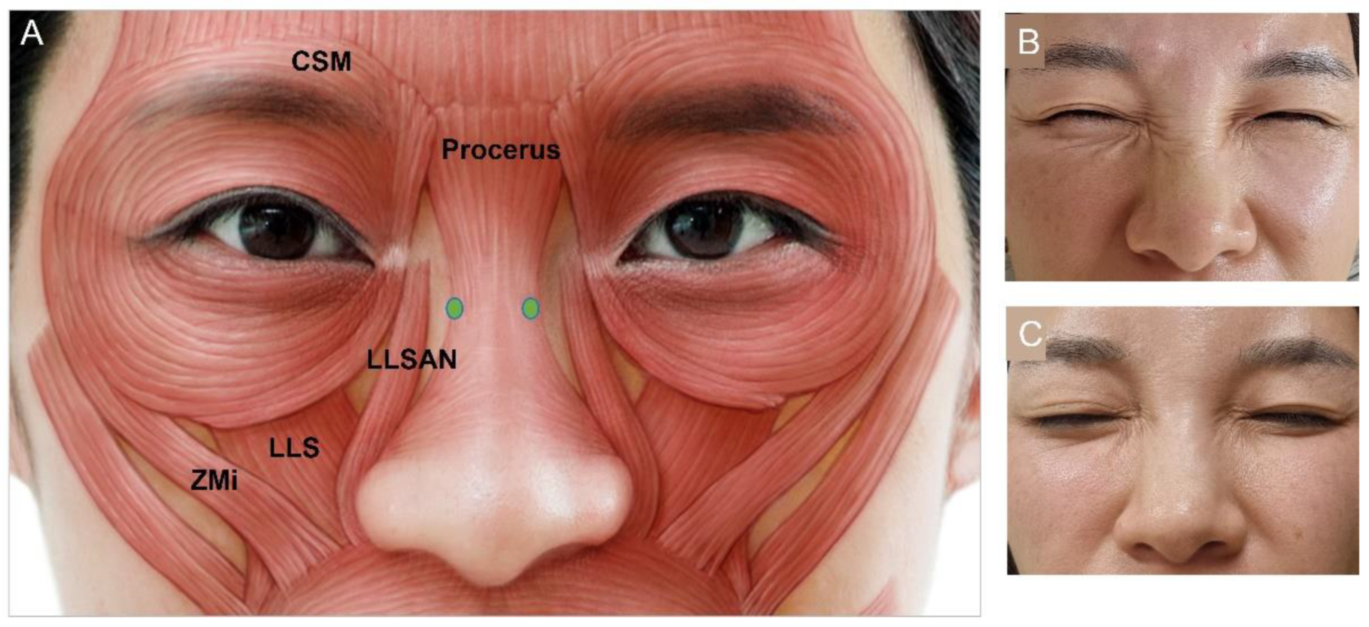 Toxins 15 00082 g005 Toxins 15 00082 g005
