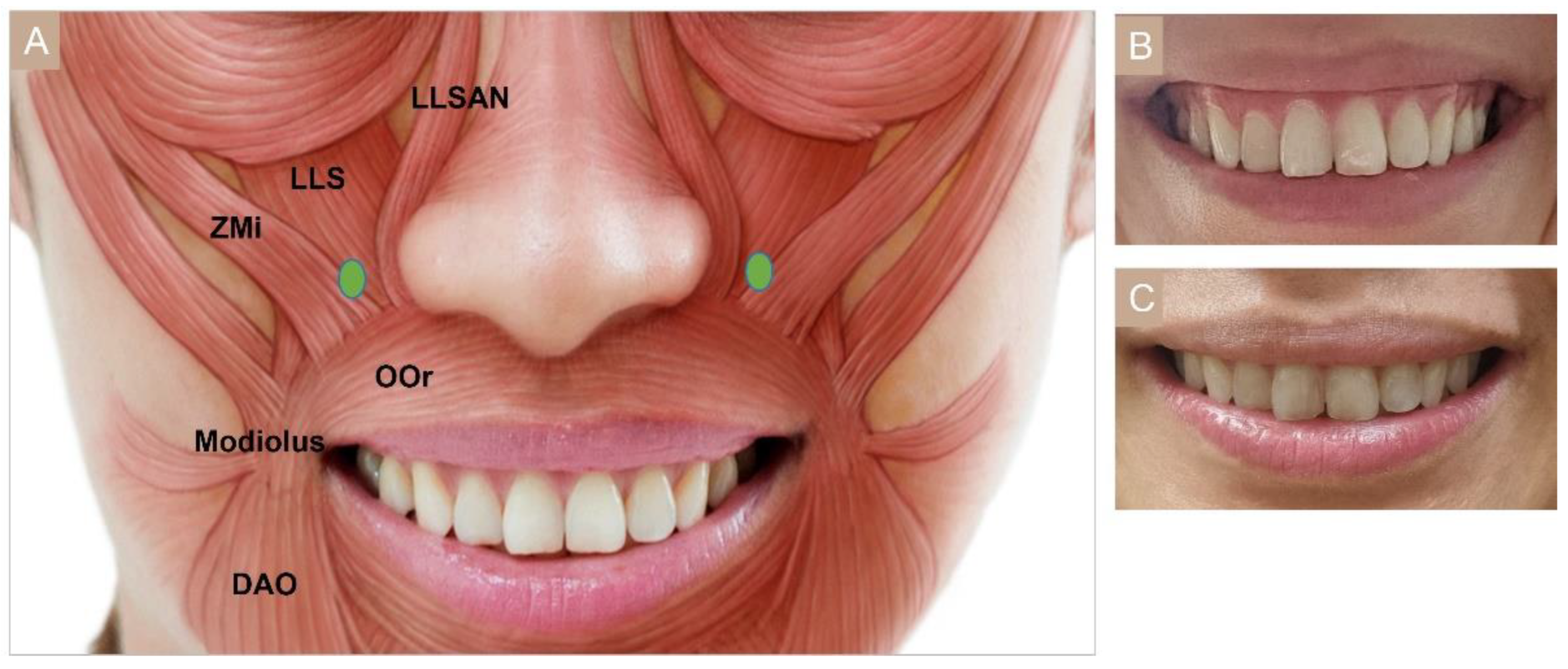 Toxins 15 00082 g006 Toxins 15 00082 g006
