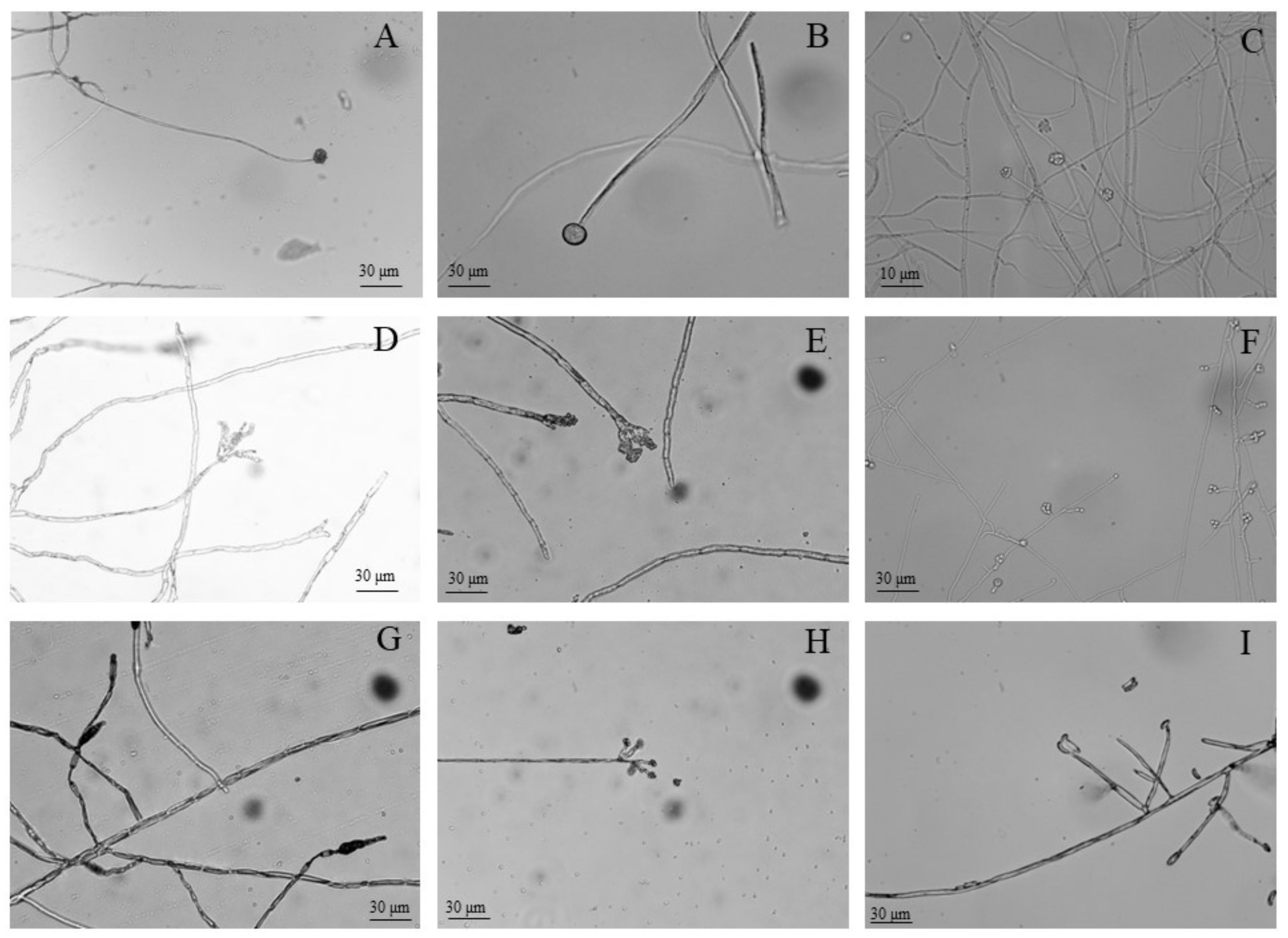 バイヤー厳選用品 Isolation of Disease Postharvest Causing Pathogens Main the その他