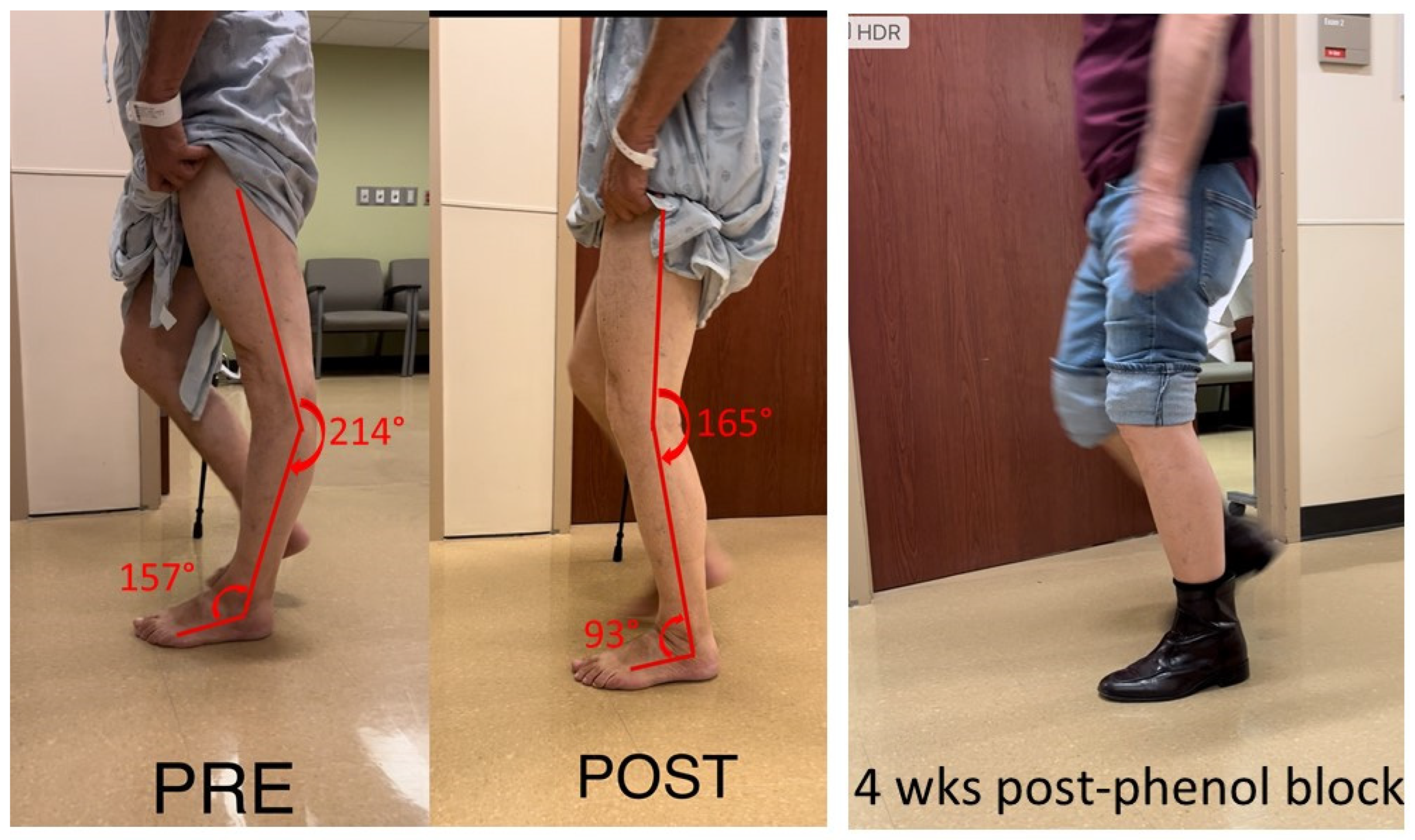 Stiff knee treatment discount
