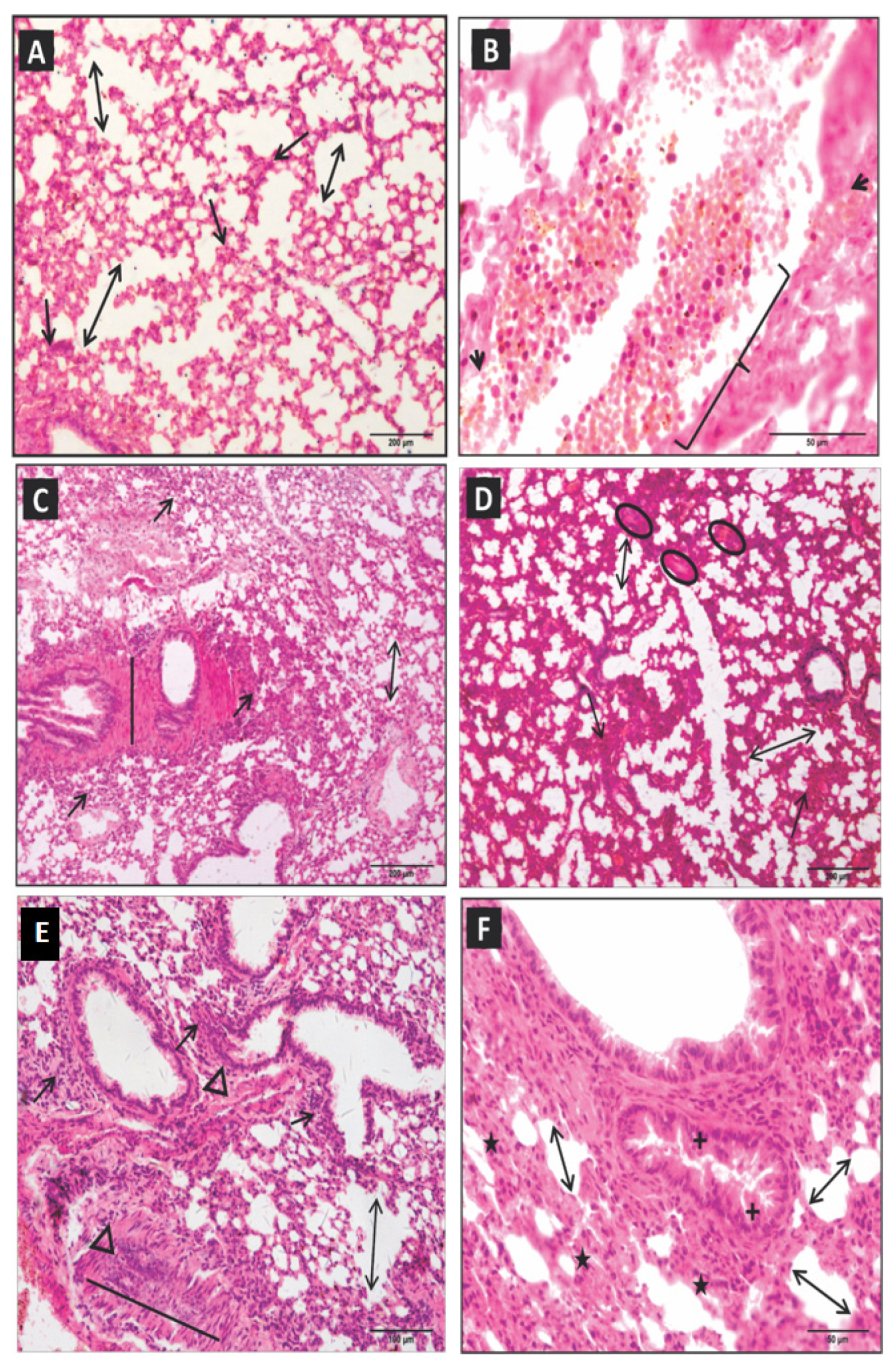 Toxins 15 00282 g002 Toxins 15 00282 g002