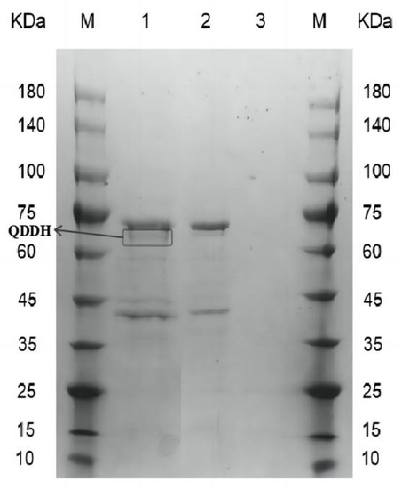 The sEVs miR-487a/Notch2/GATA3 axis promotes osteosarcoma