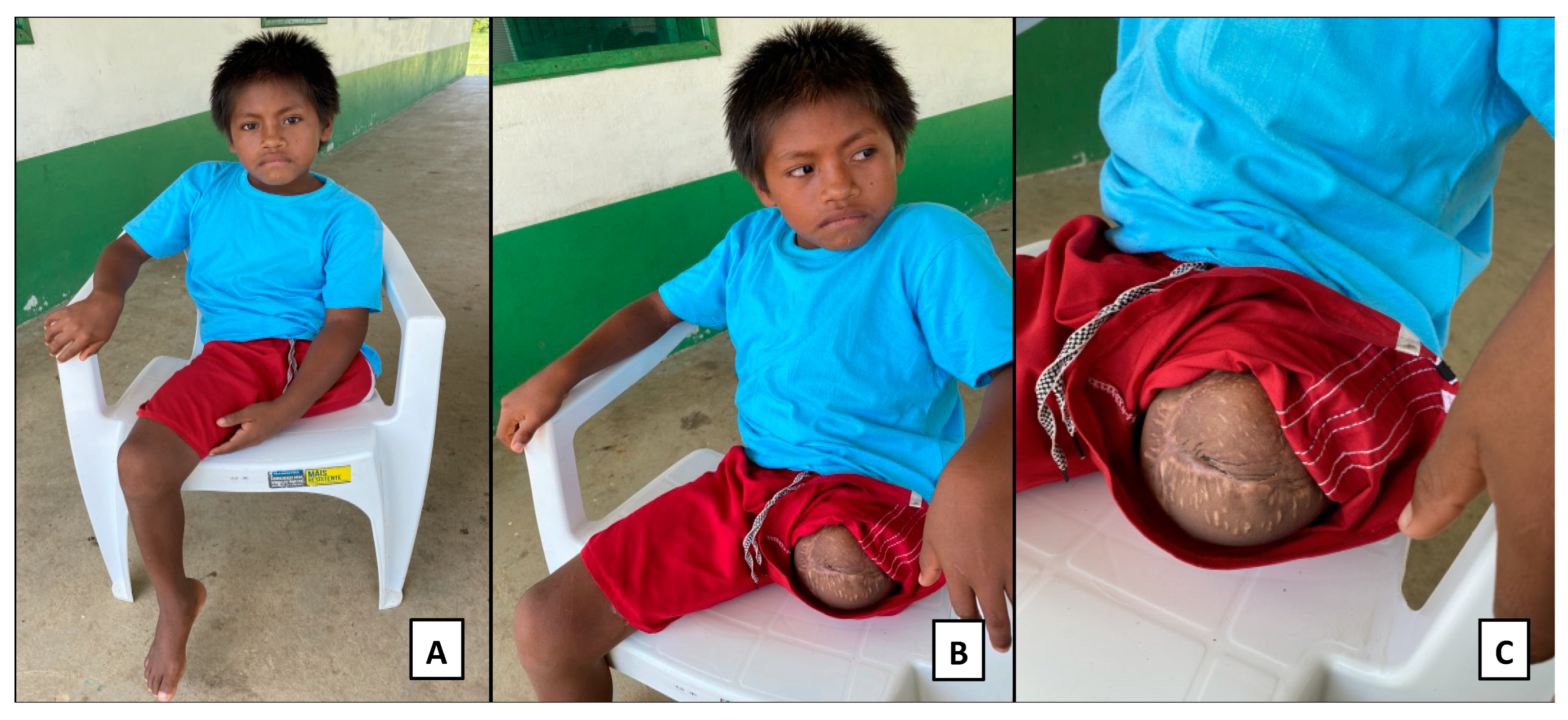 Toxins 15 00352 g003 Toxins 15 00352 g003