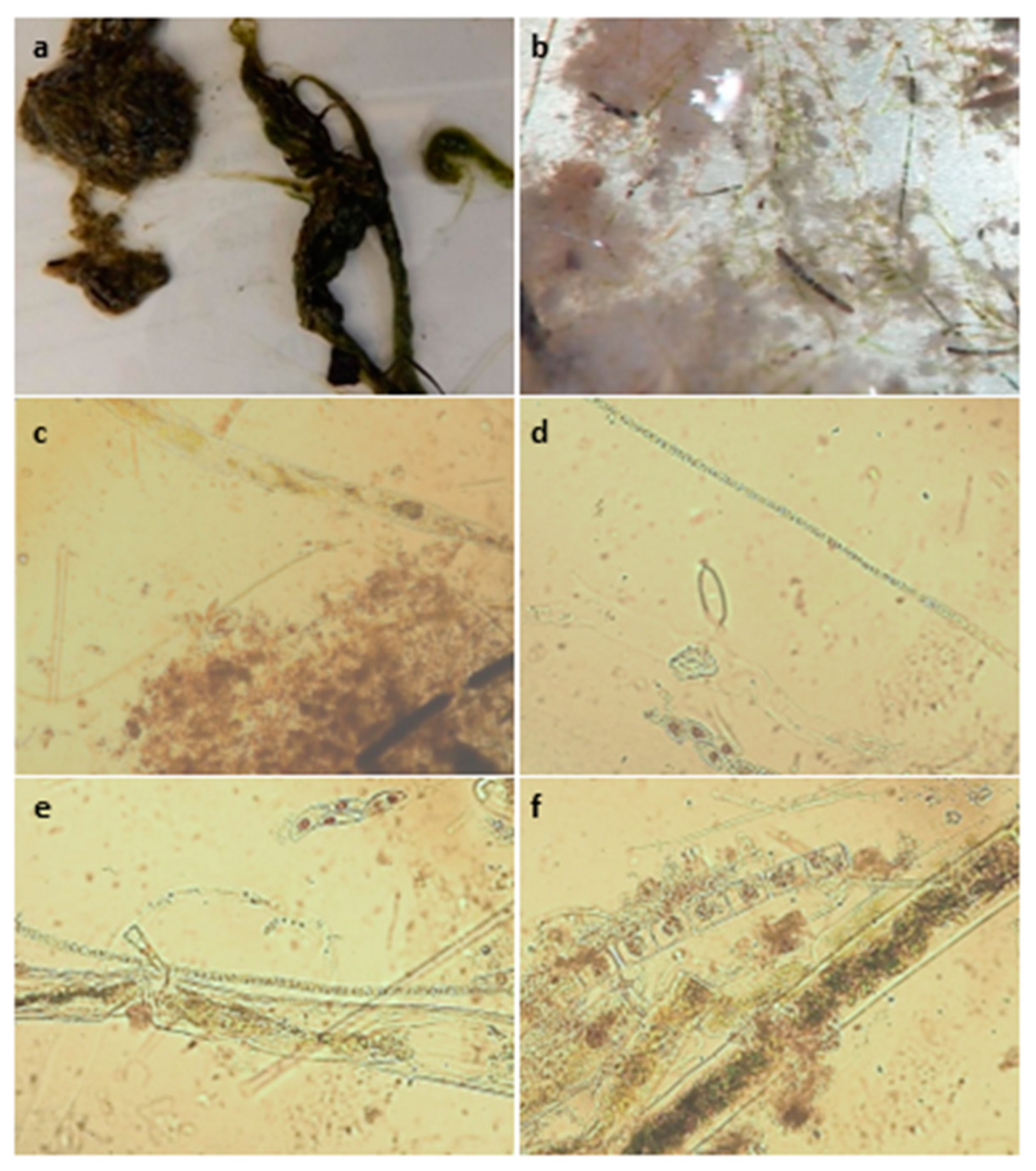 Toxins 15 00485 g002