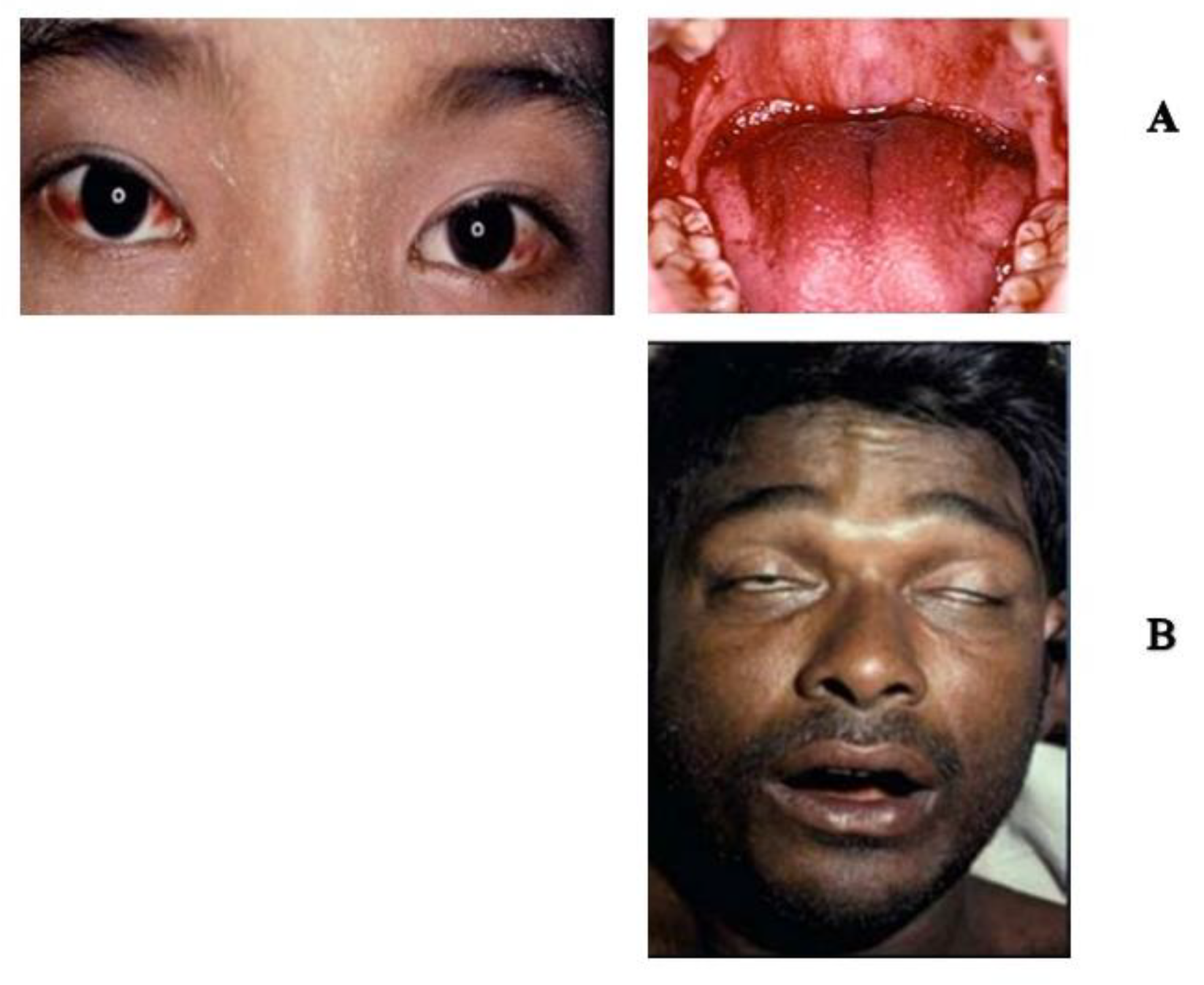 Toxins 15 00517 g002