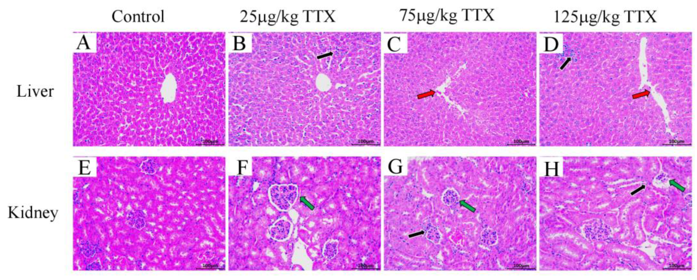 Toxins 15 00564 g005