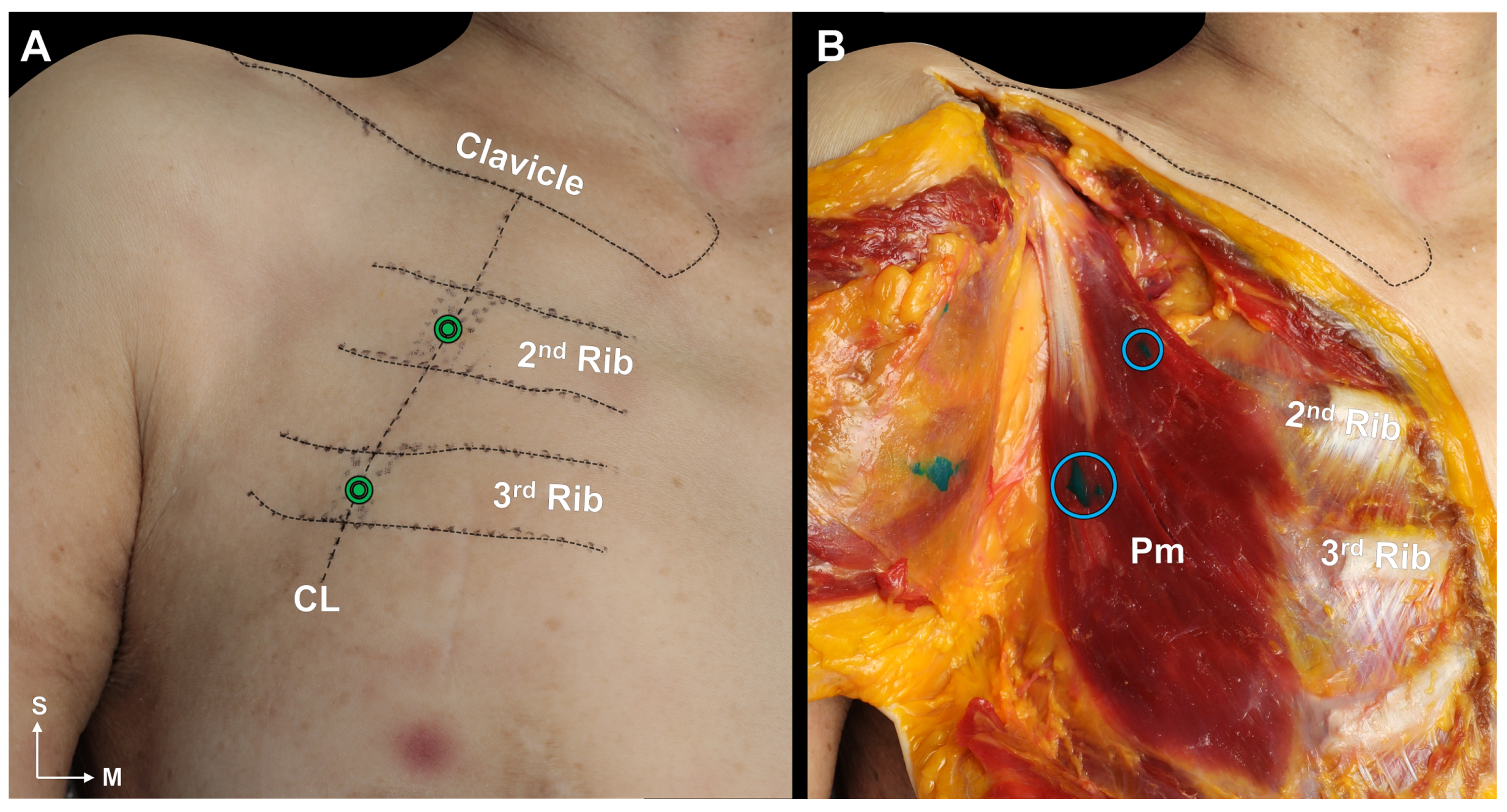Toxins 15 00603 g003 Toxins 15 00603 g003