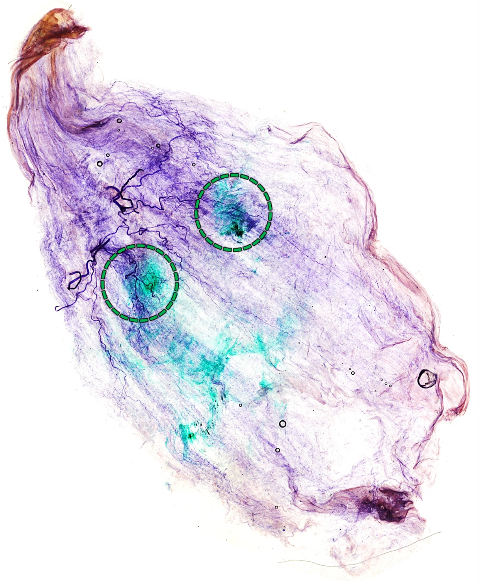 Toxins 15 00603 g004 Toxins 15 00603 g004