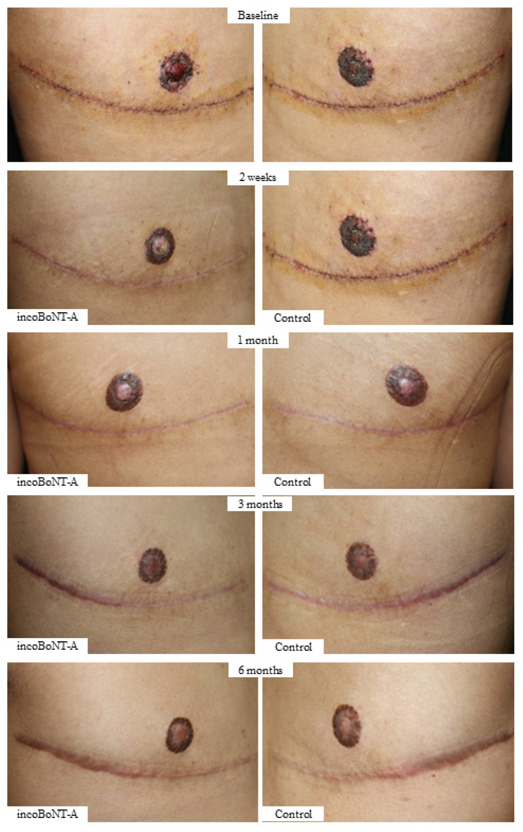 Toxins 15 00636 g006