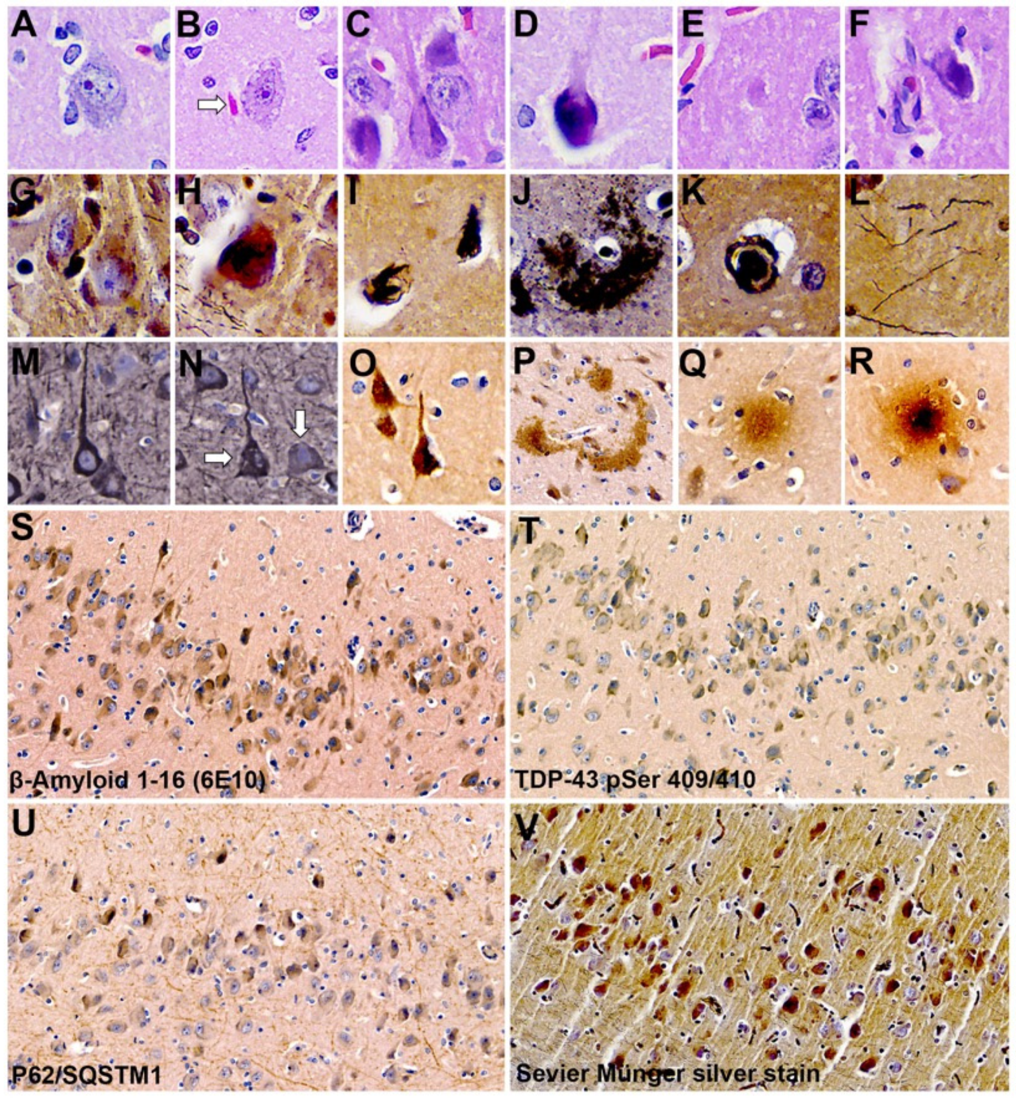 Toxins 16 00042 g003