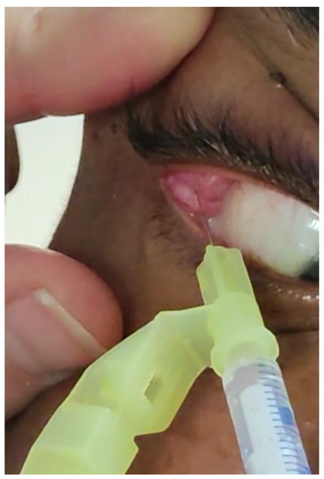 Toxins 16 00161 g001