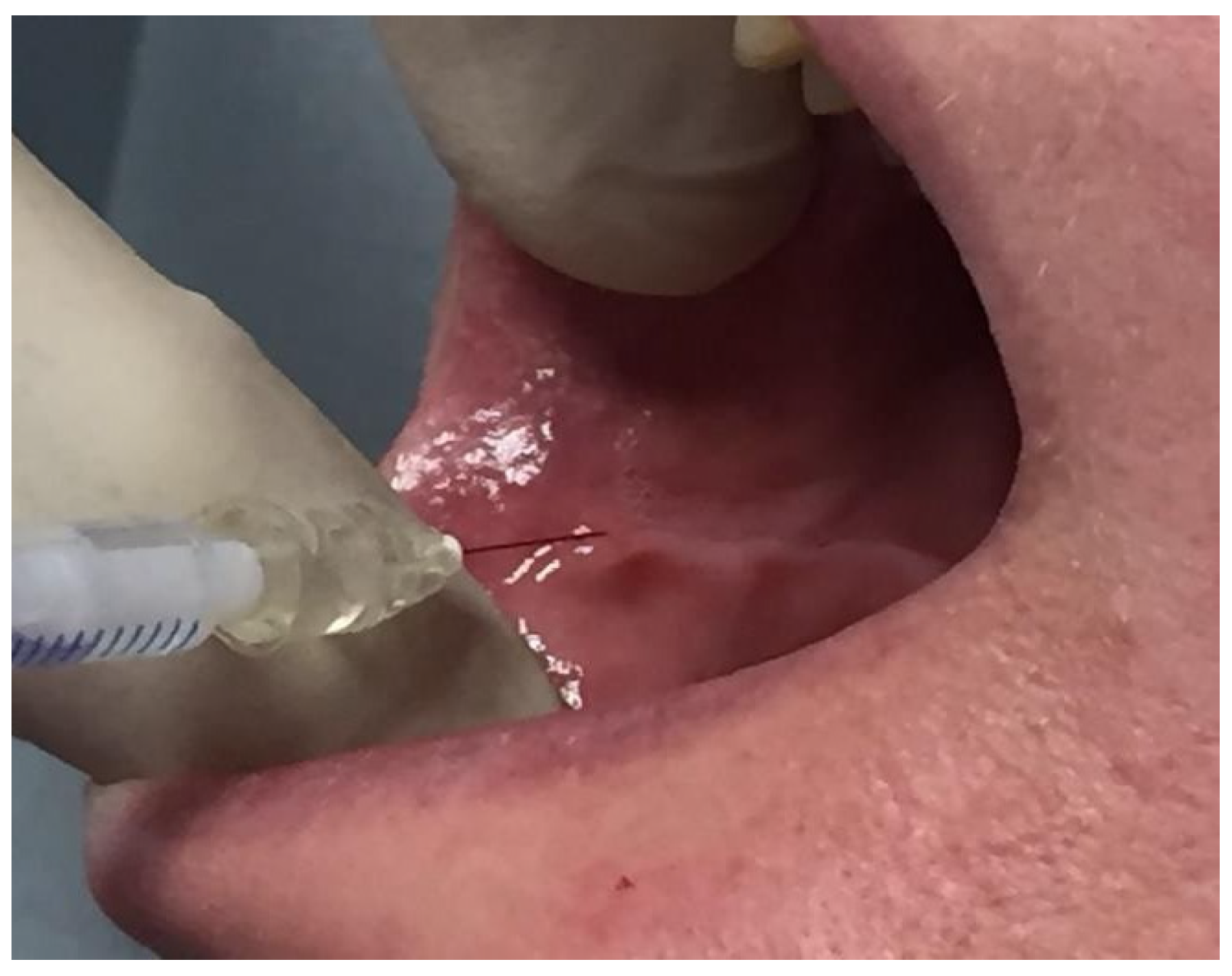 Toxins 16 00161 g002