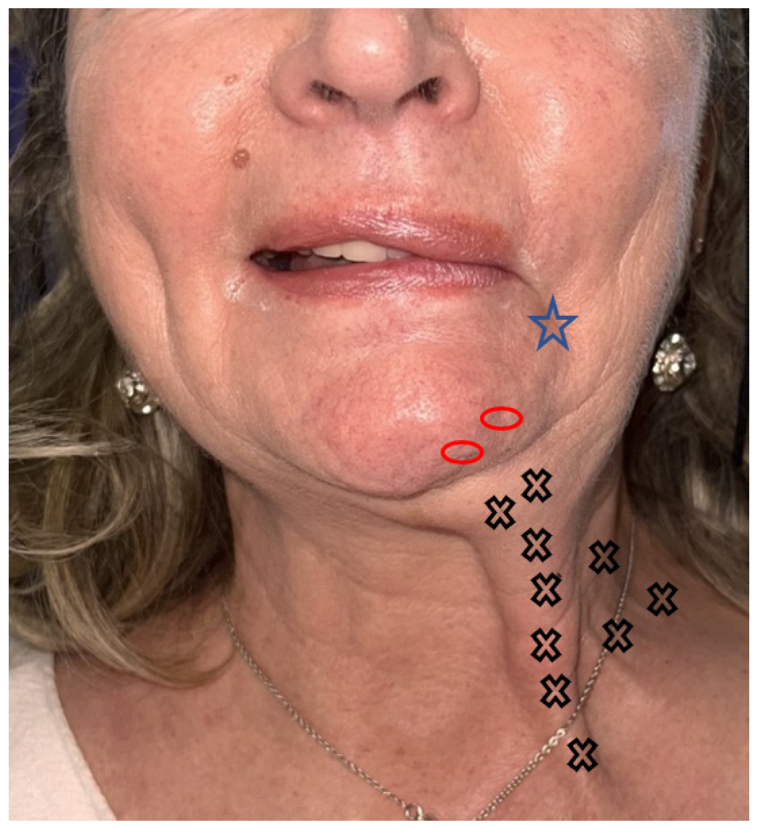 Toxins 16 00161 g004