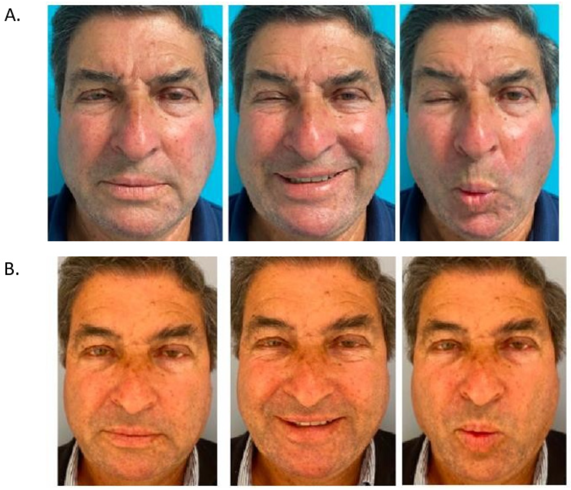 Toxins 16 00161 g006