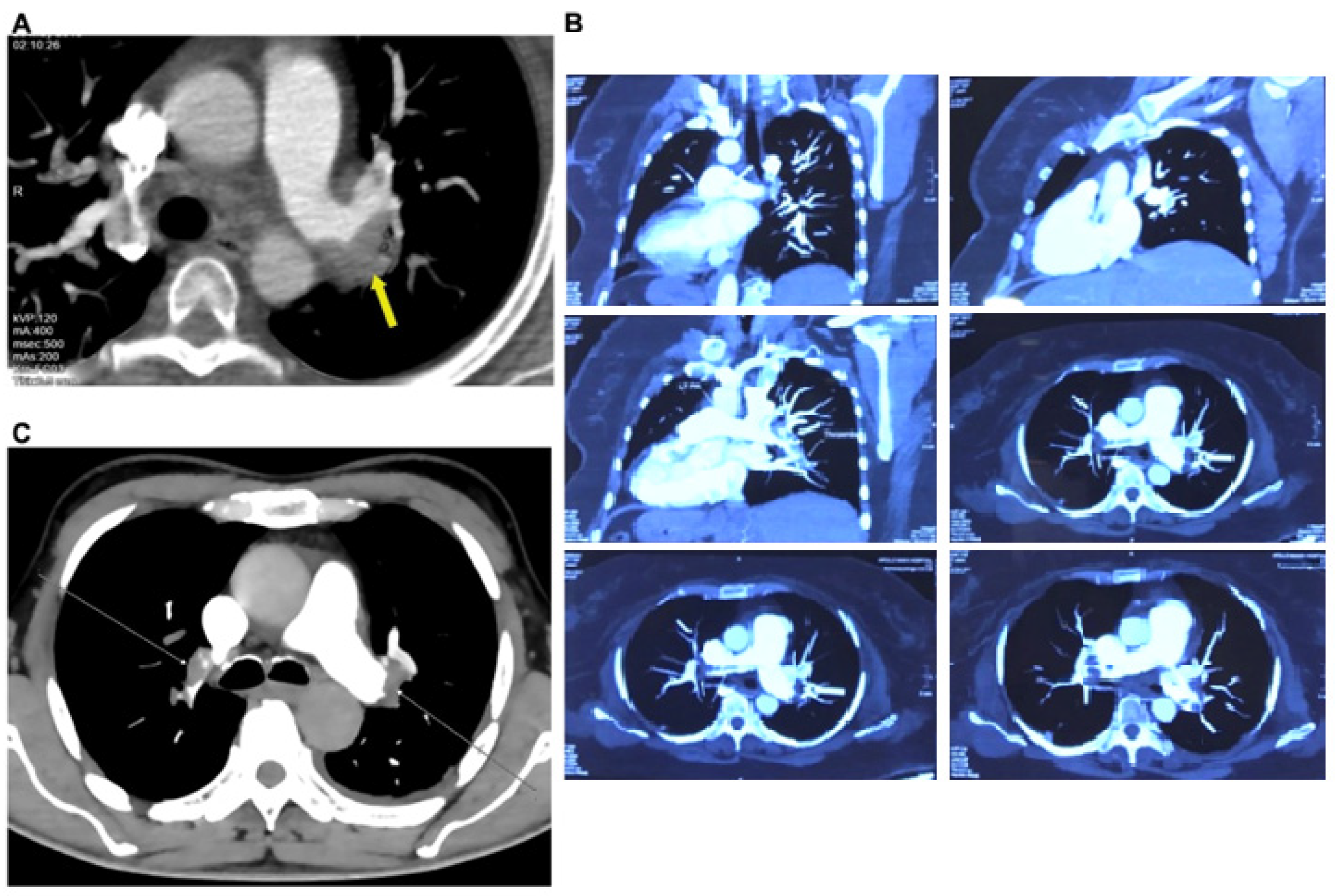 Toxins 16 00222 g003