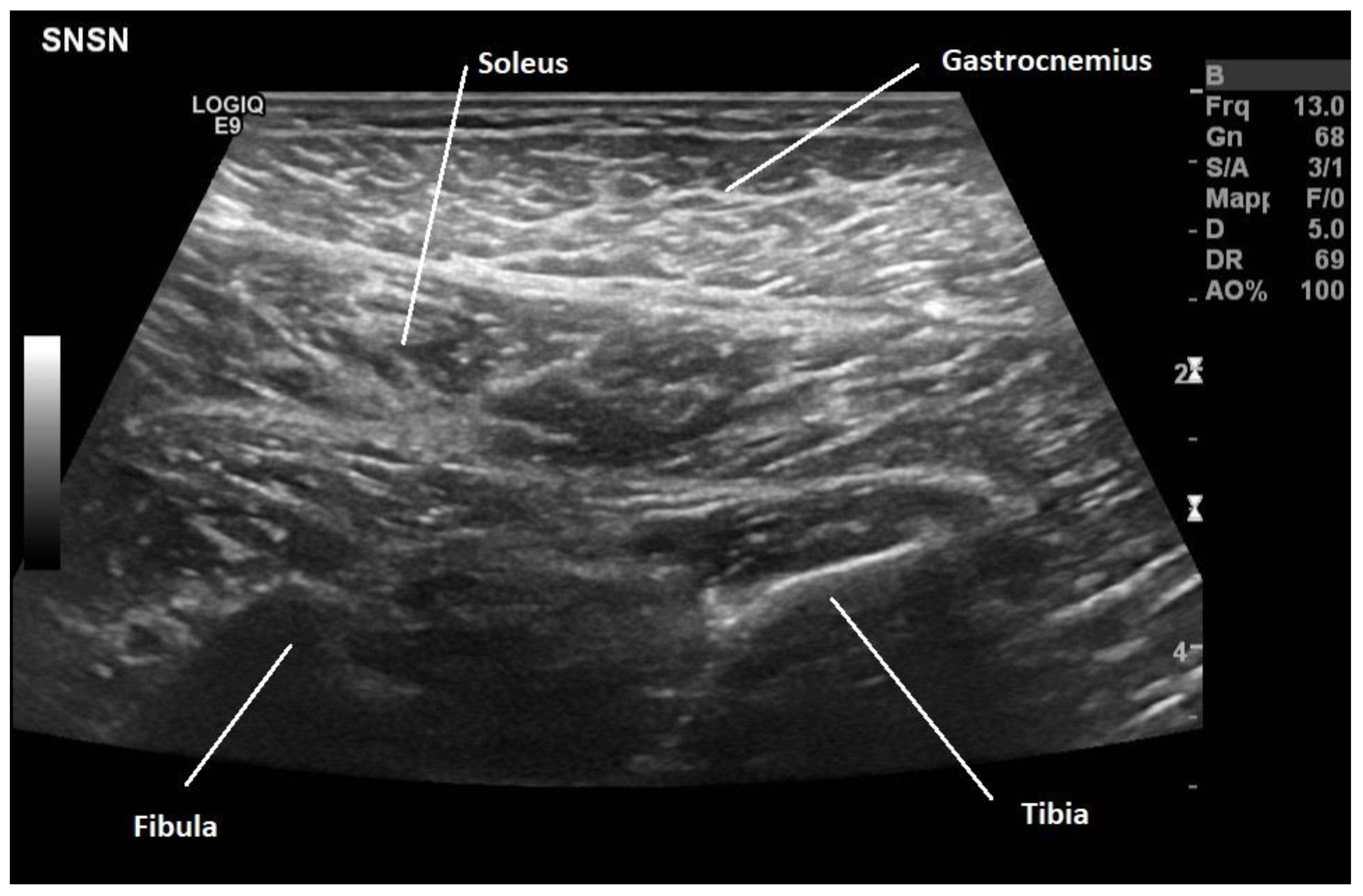 Toxins 16 00474 g001