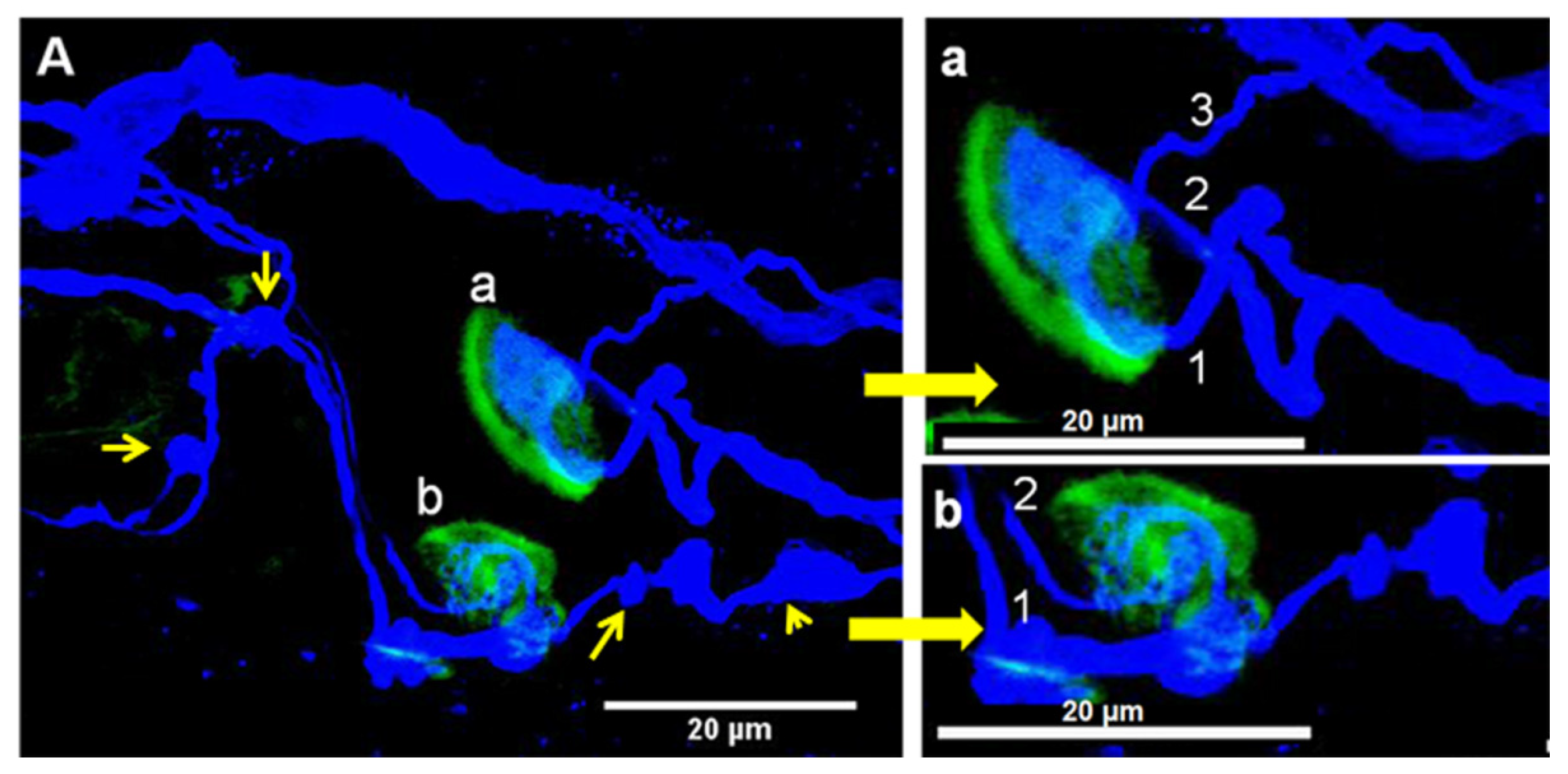 Toxins 16 00506 g004
