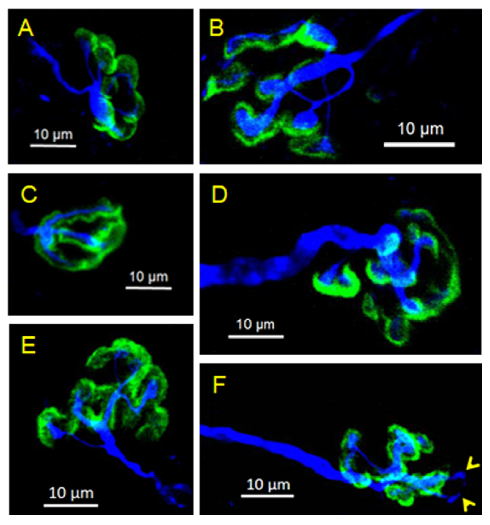 Toxins 16 00506 g006