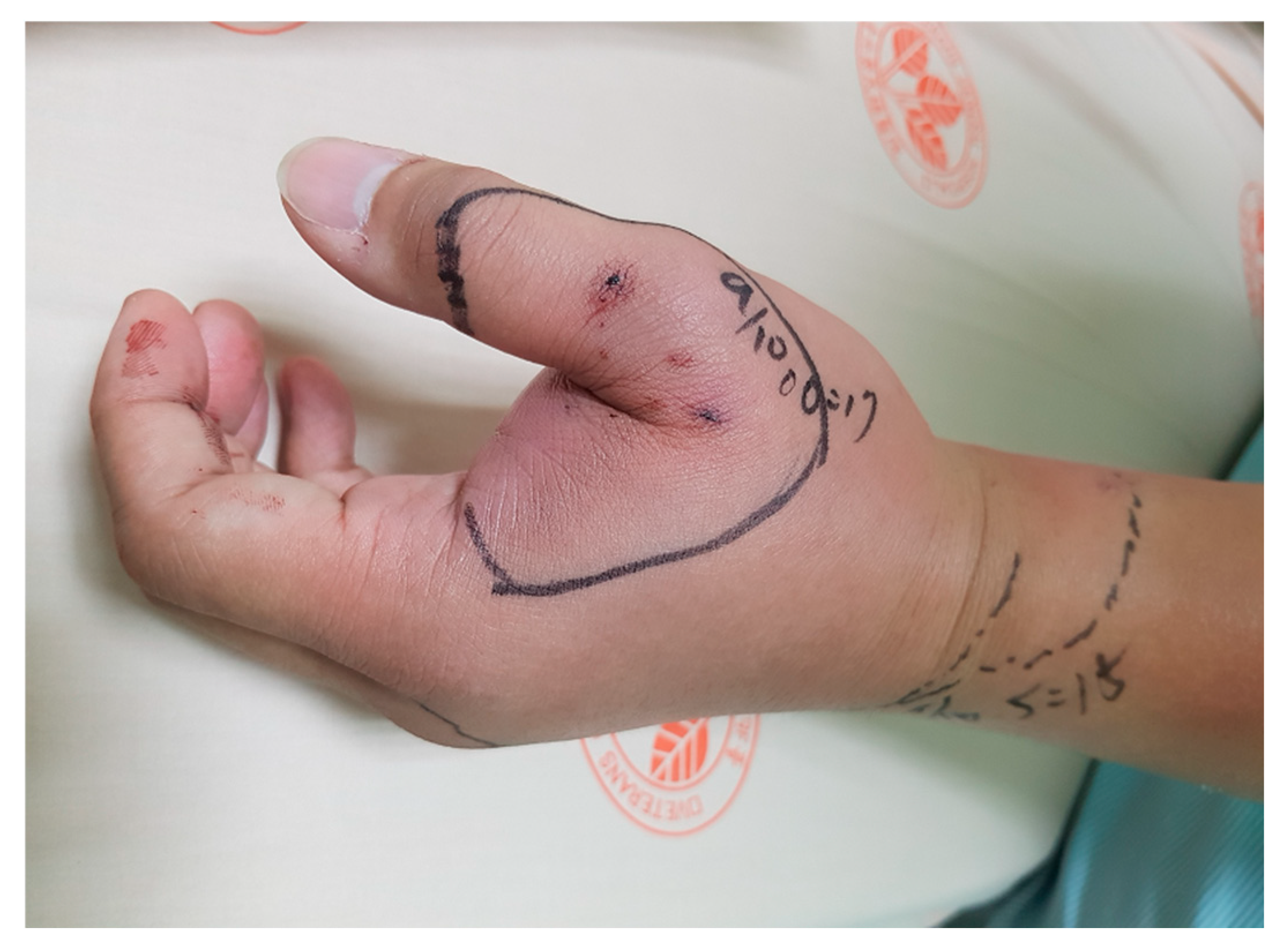 Toxins 17 00014 g005