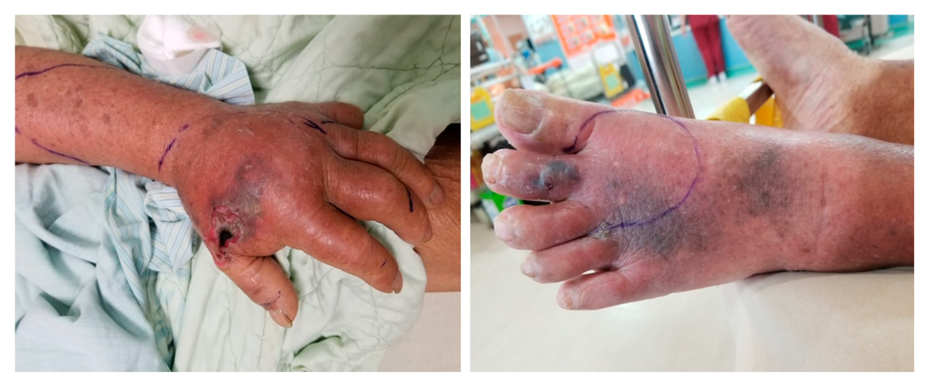 Toxins 17 00014 g006