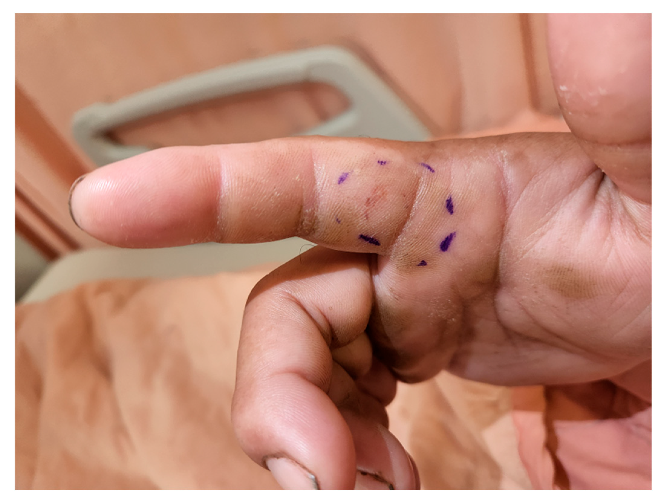 Toxins 17 00014 g007