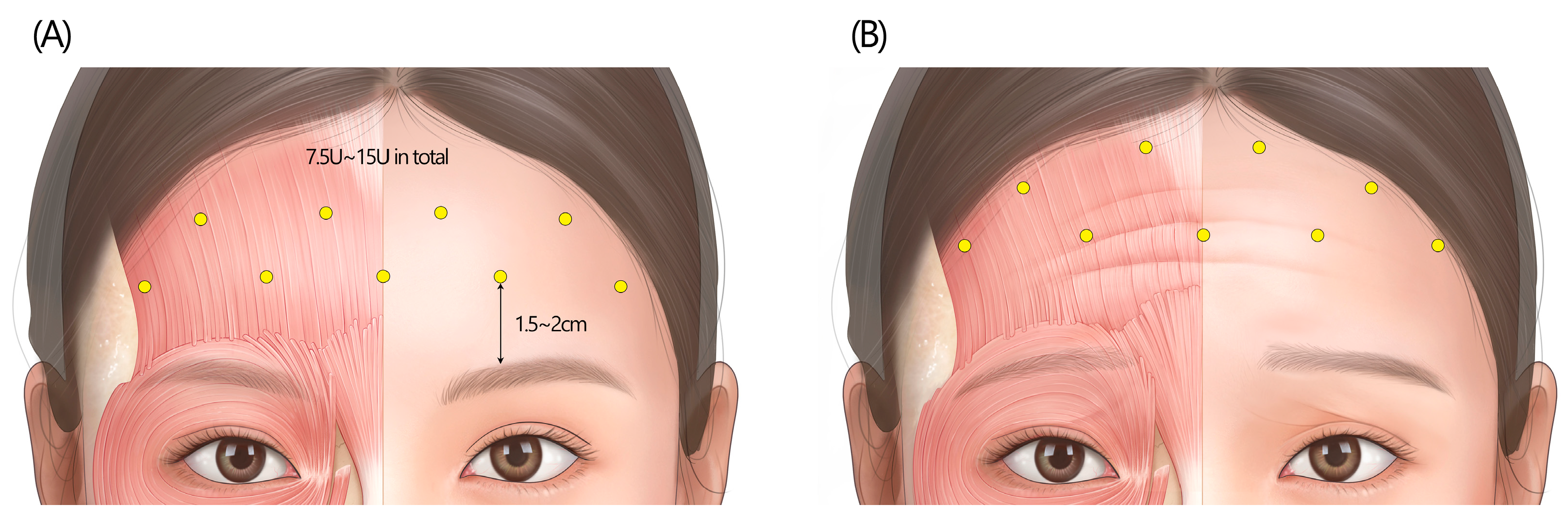 Toxins 17 00061 g004