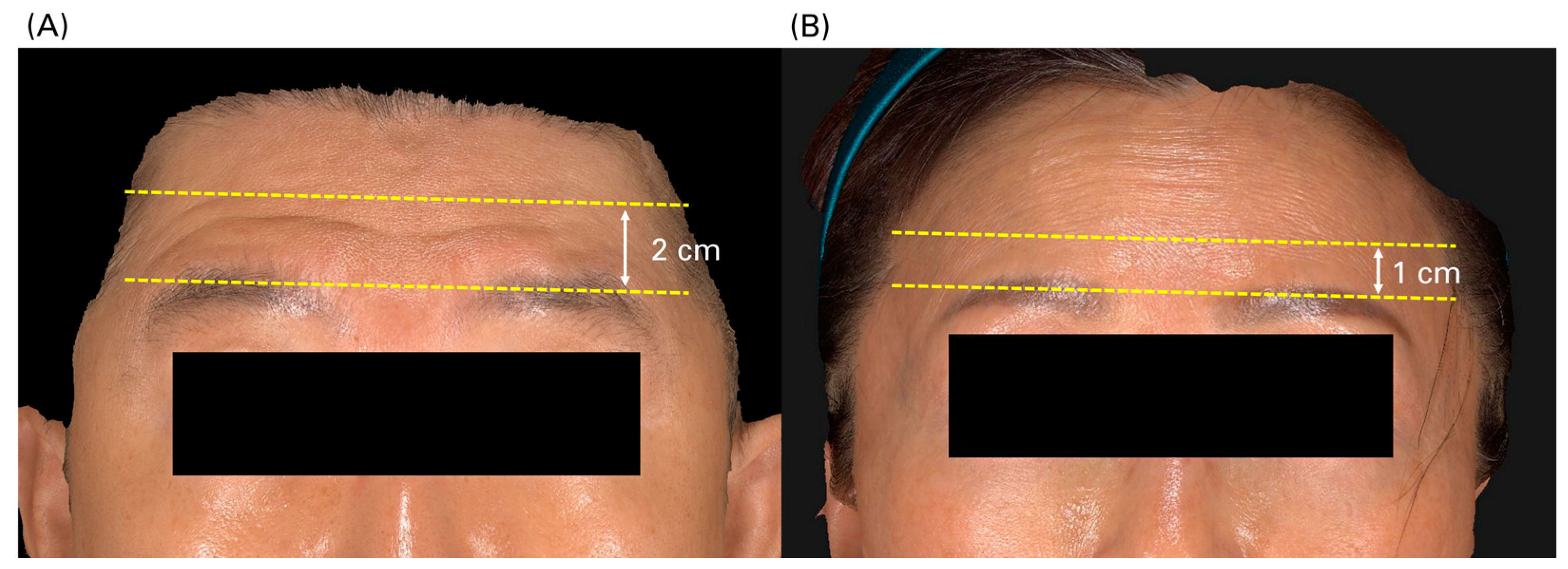 Toxins 17 00061 g005