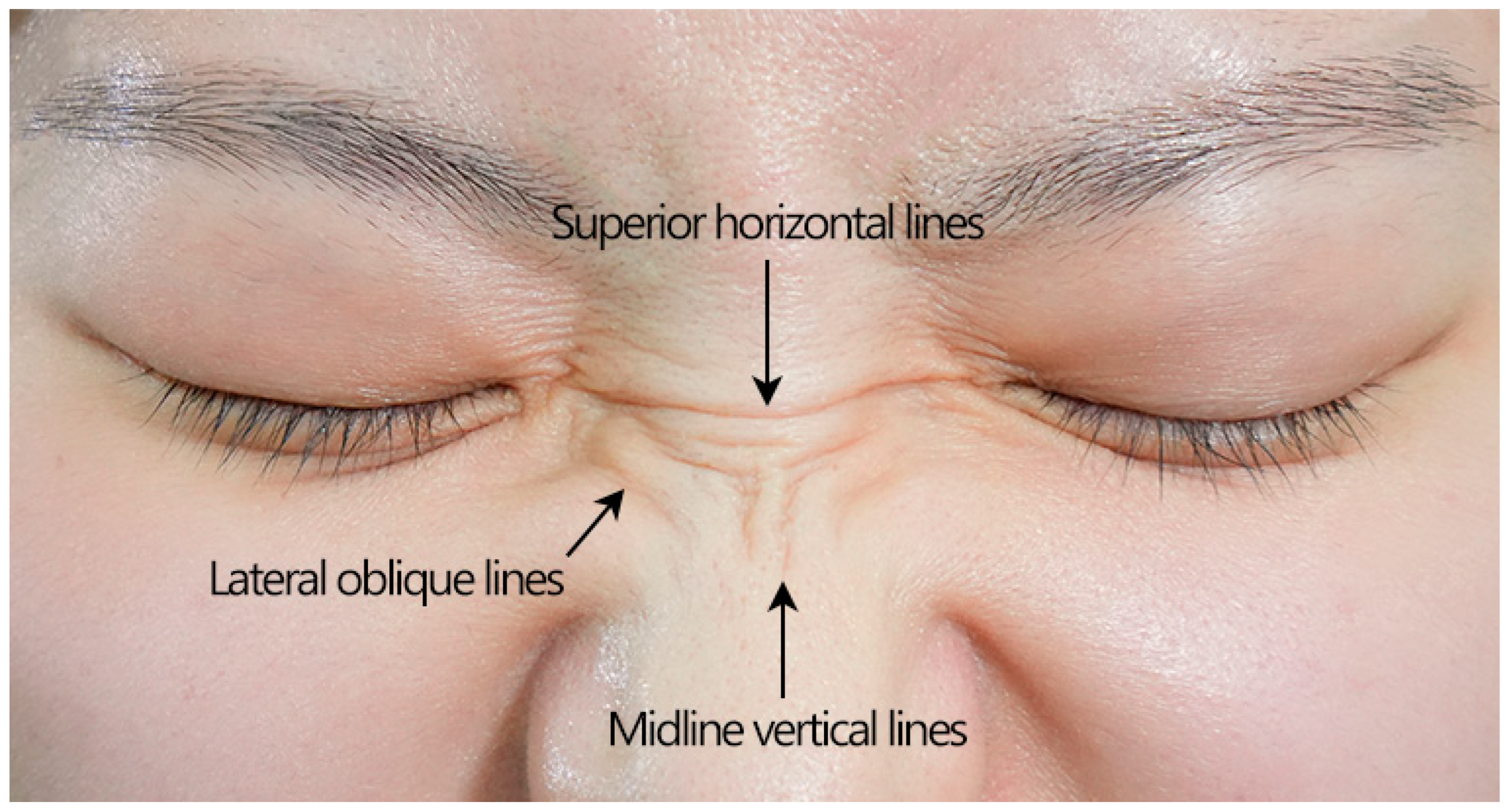 Toxins 17 00061 g007