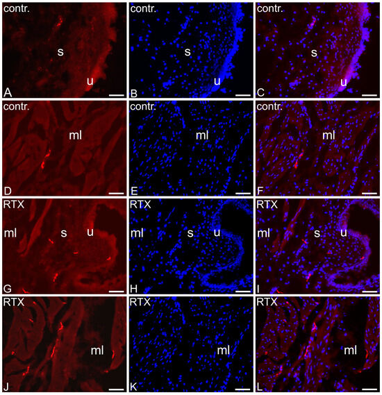 MicroRNA-99 family in cancer: molecular mechanisms for