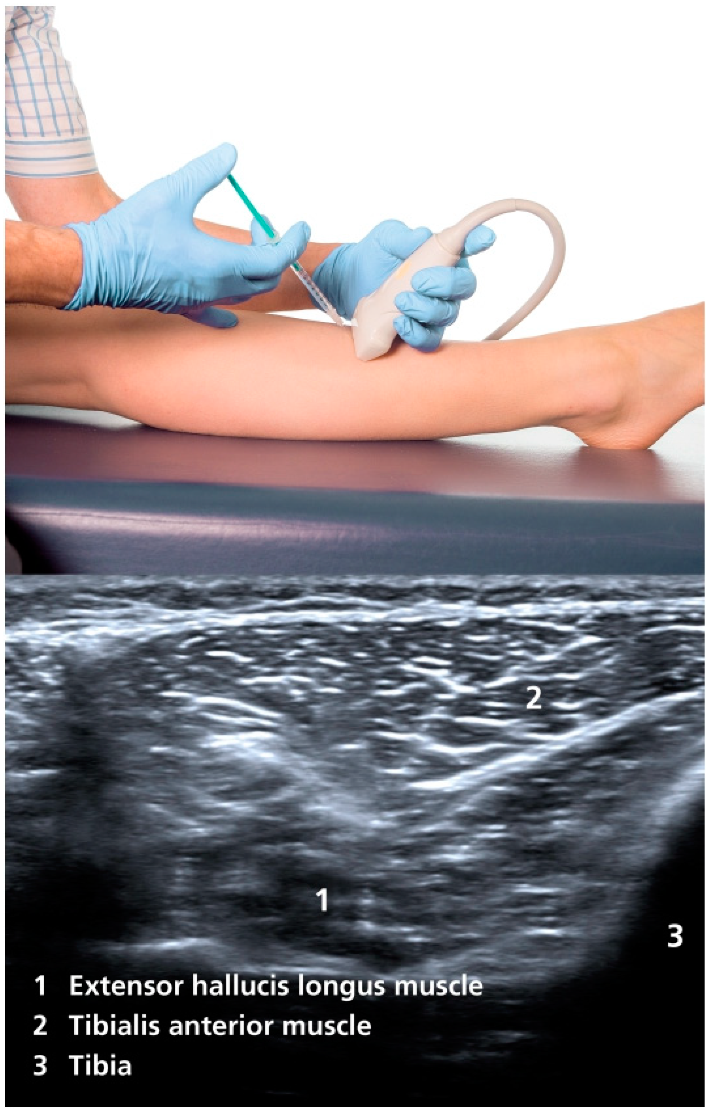 Toxins 17 00168 g001