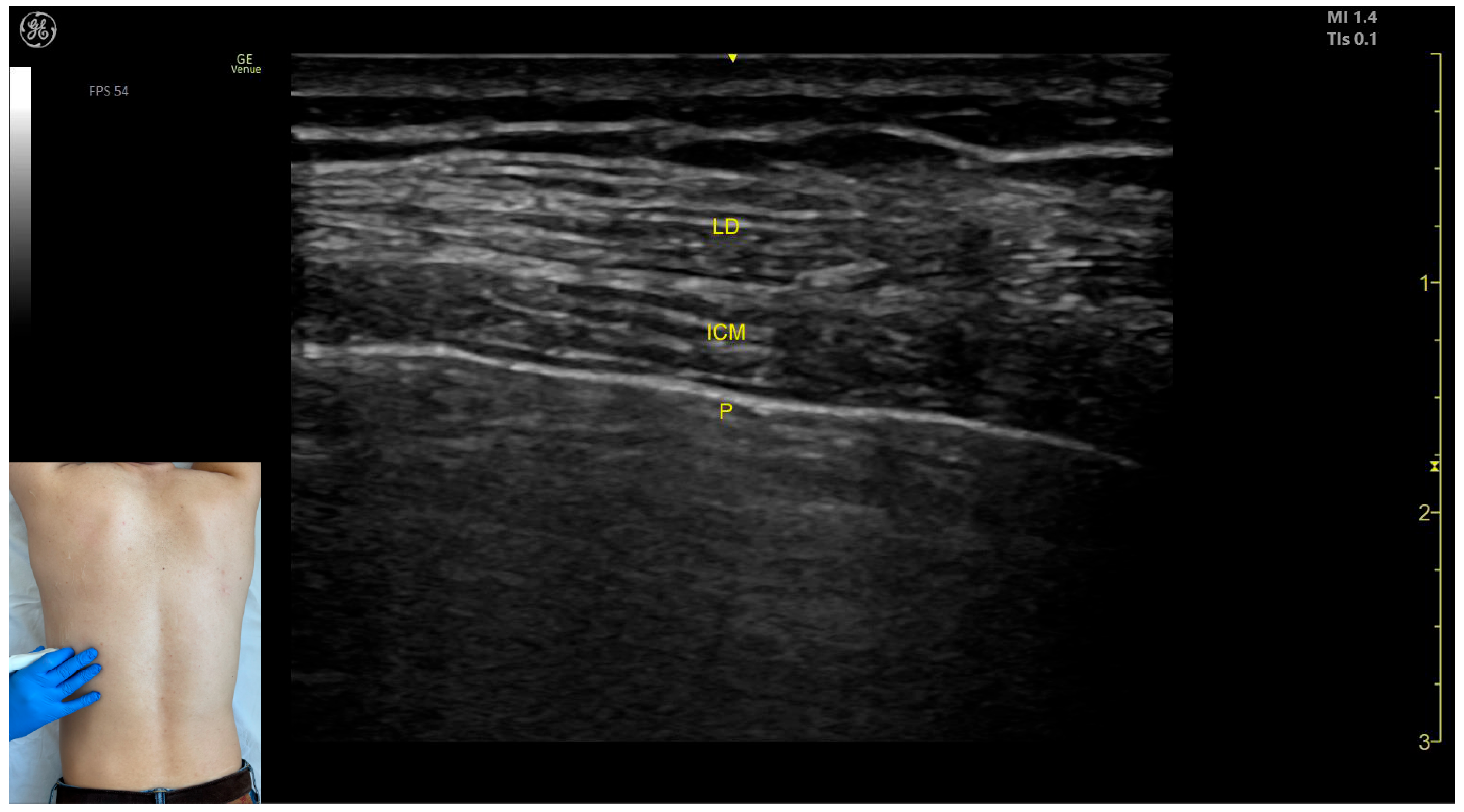 Toxins 17 00276 g001
