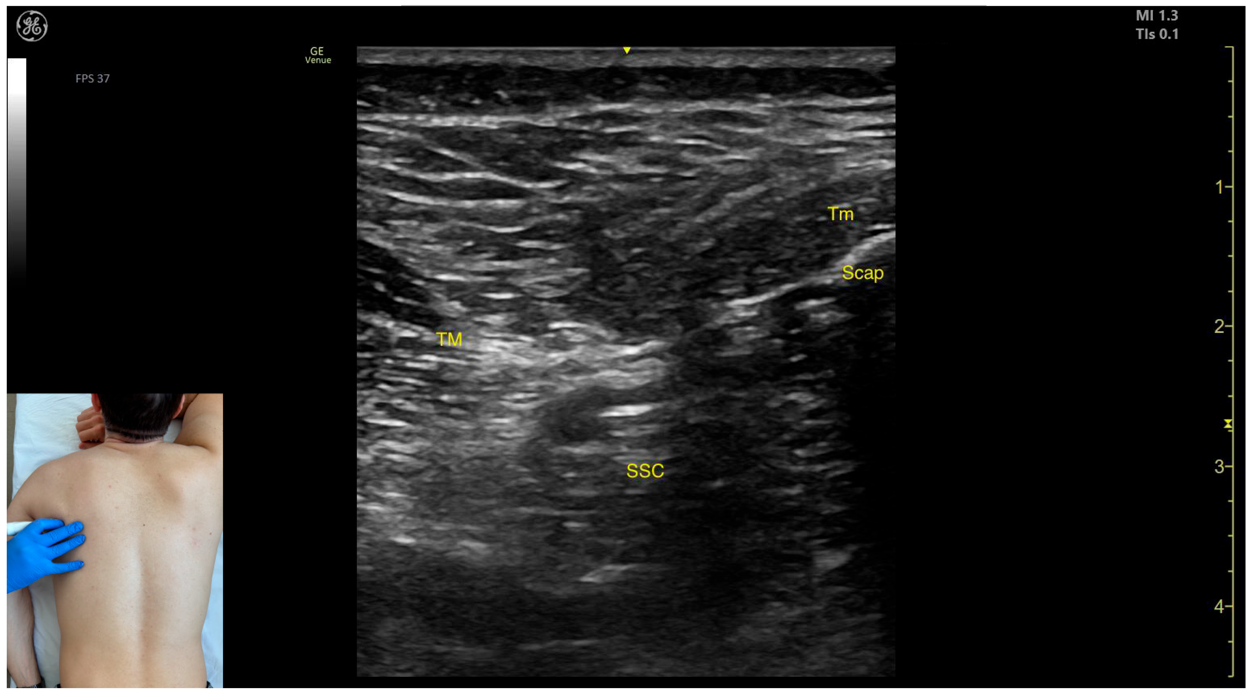 Toxins 17 00276 g003