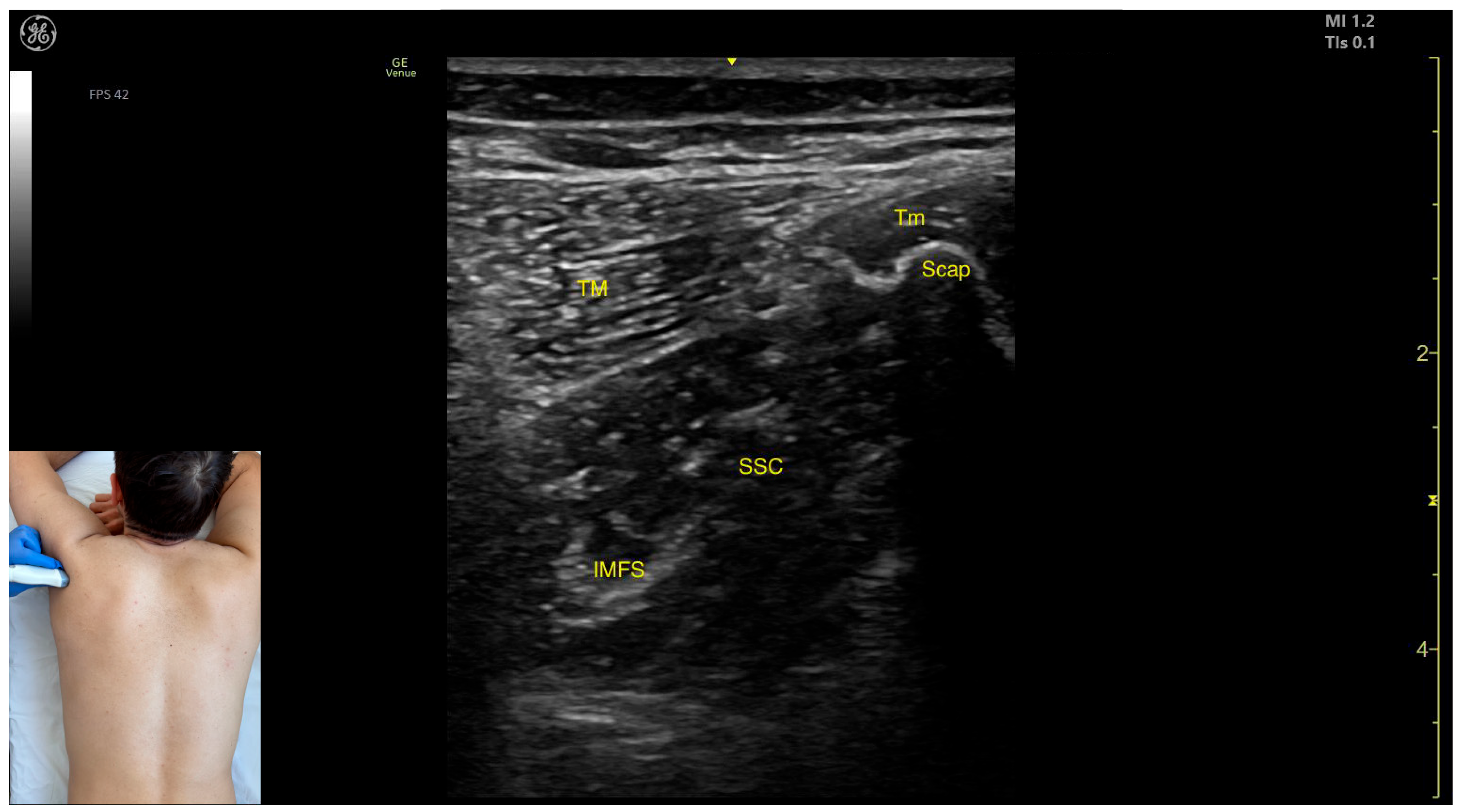 Toxins 17 00276 g004