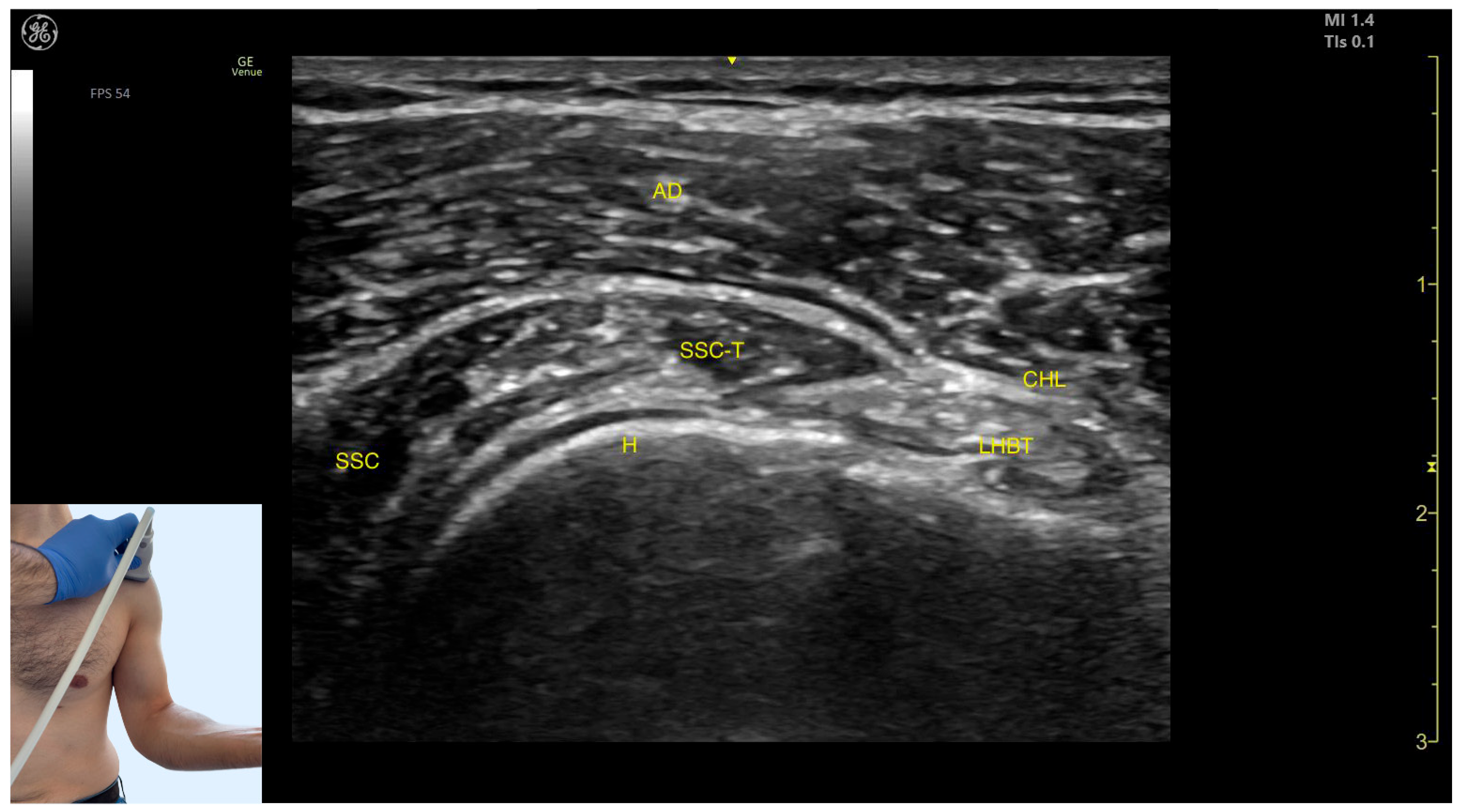 Toxins 17 00276 g005
