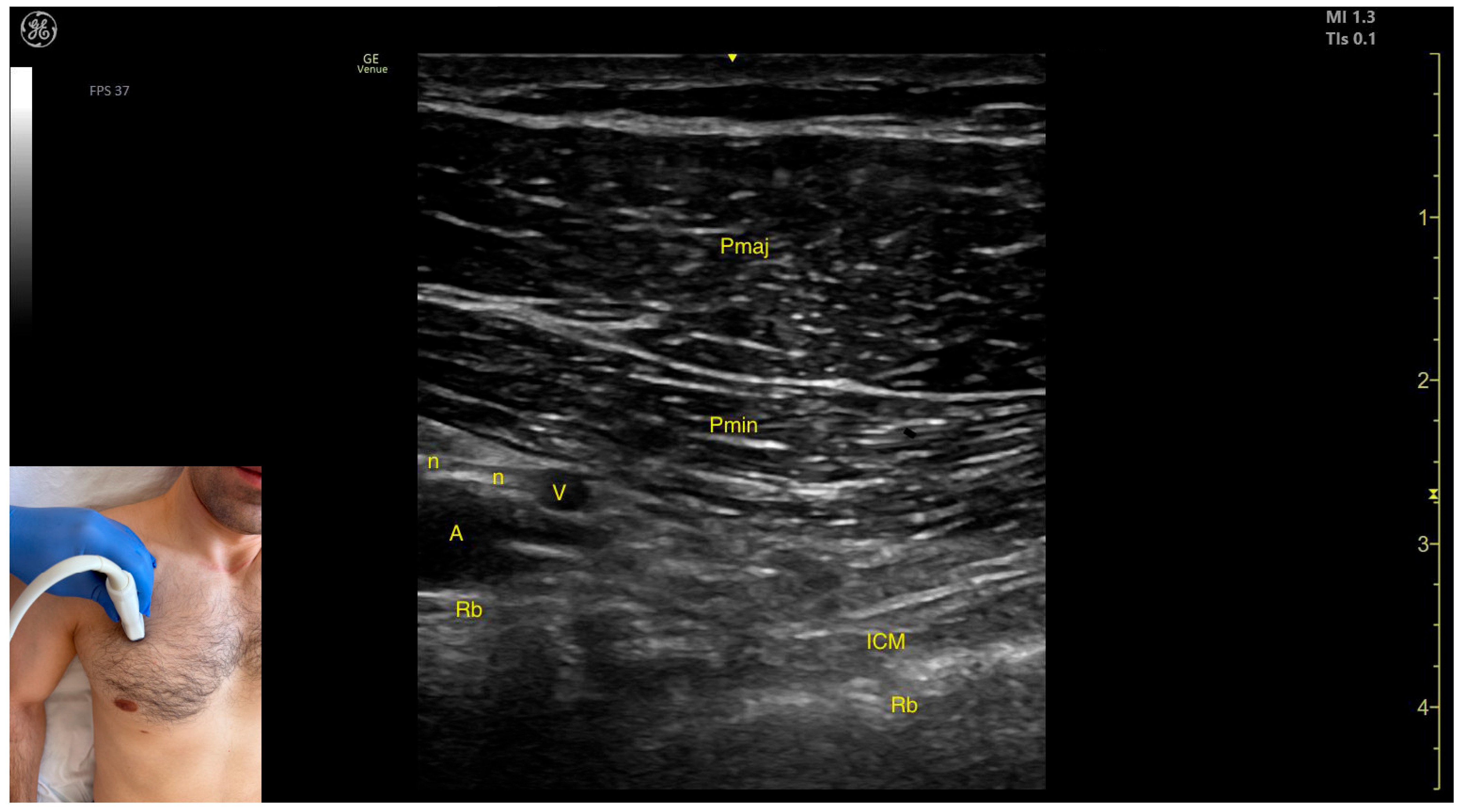 Toxins 17 00276 g007
