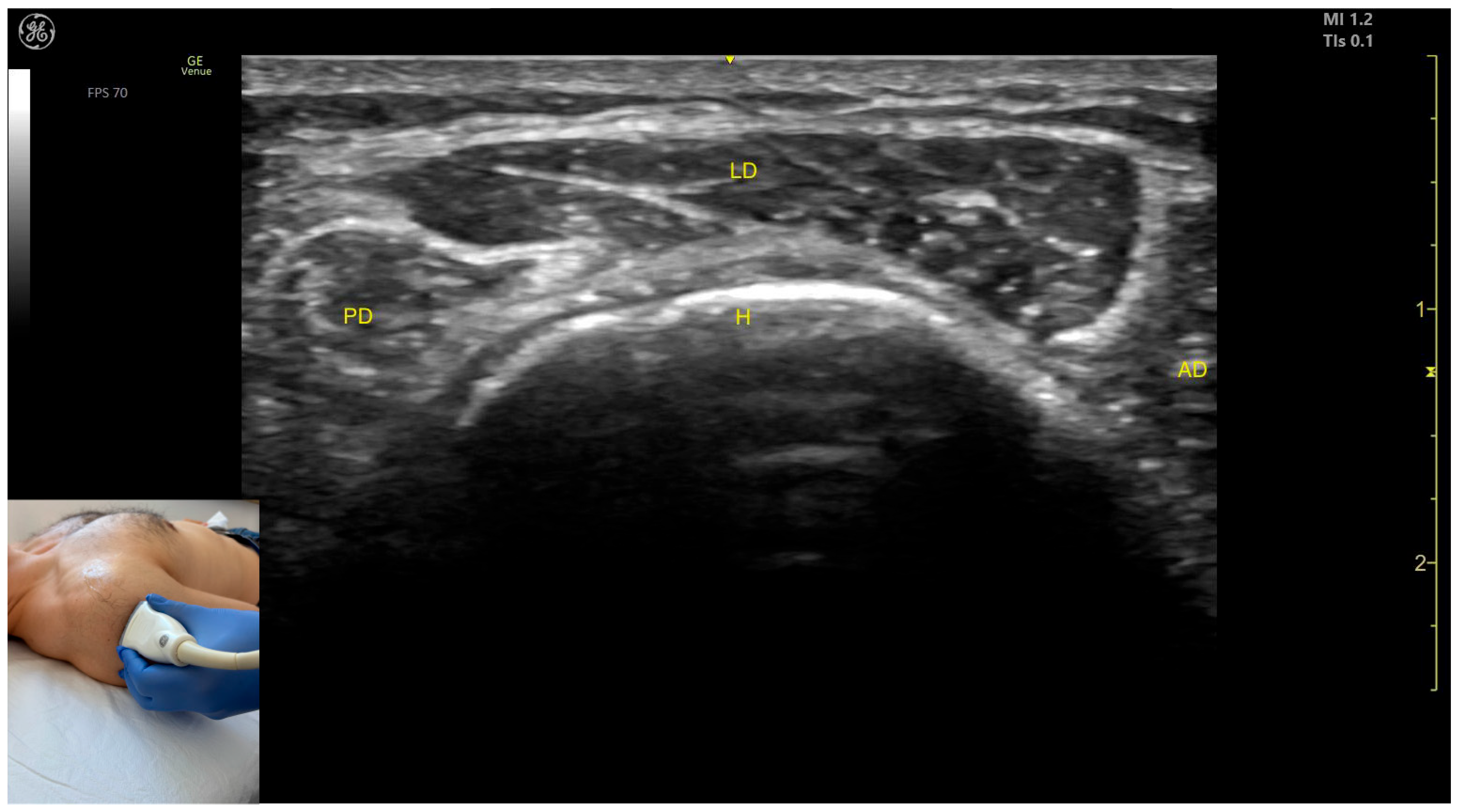 Toxins 17 00276 g009
