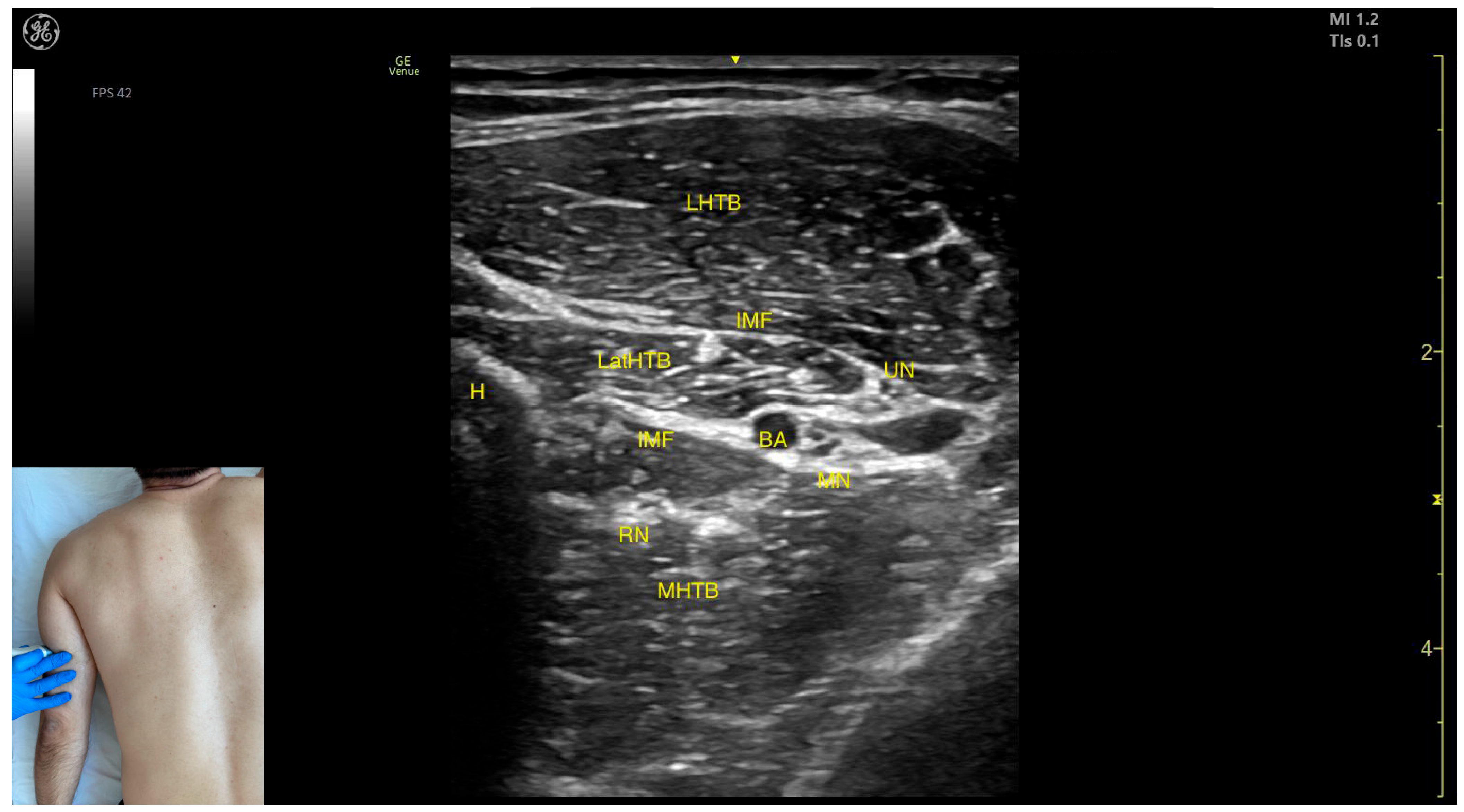 Toxins 17 00276 g011