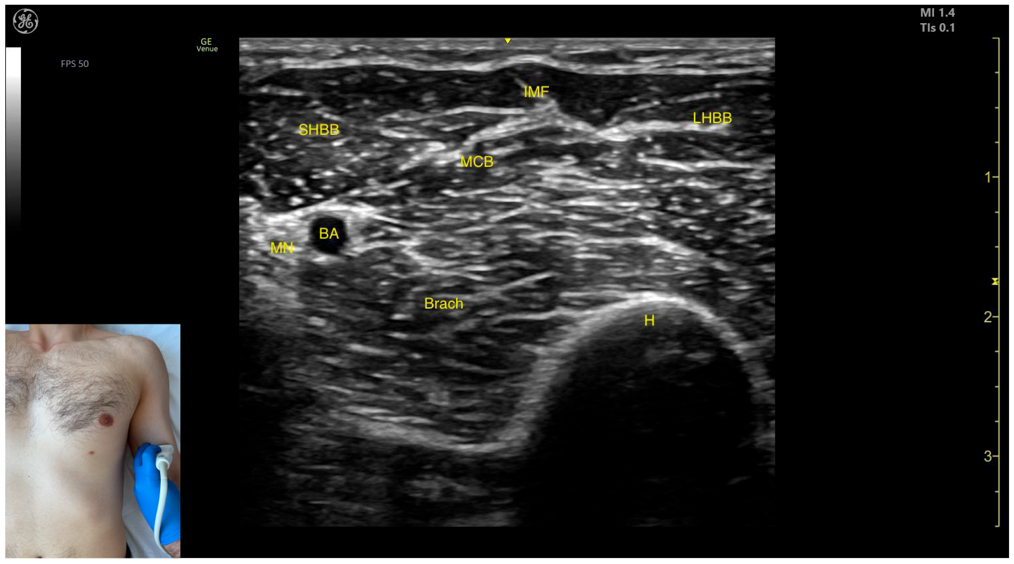 Toxins 17 00276 g012
