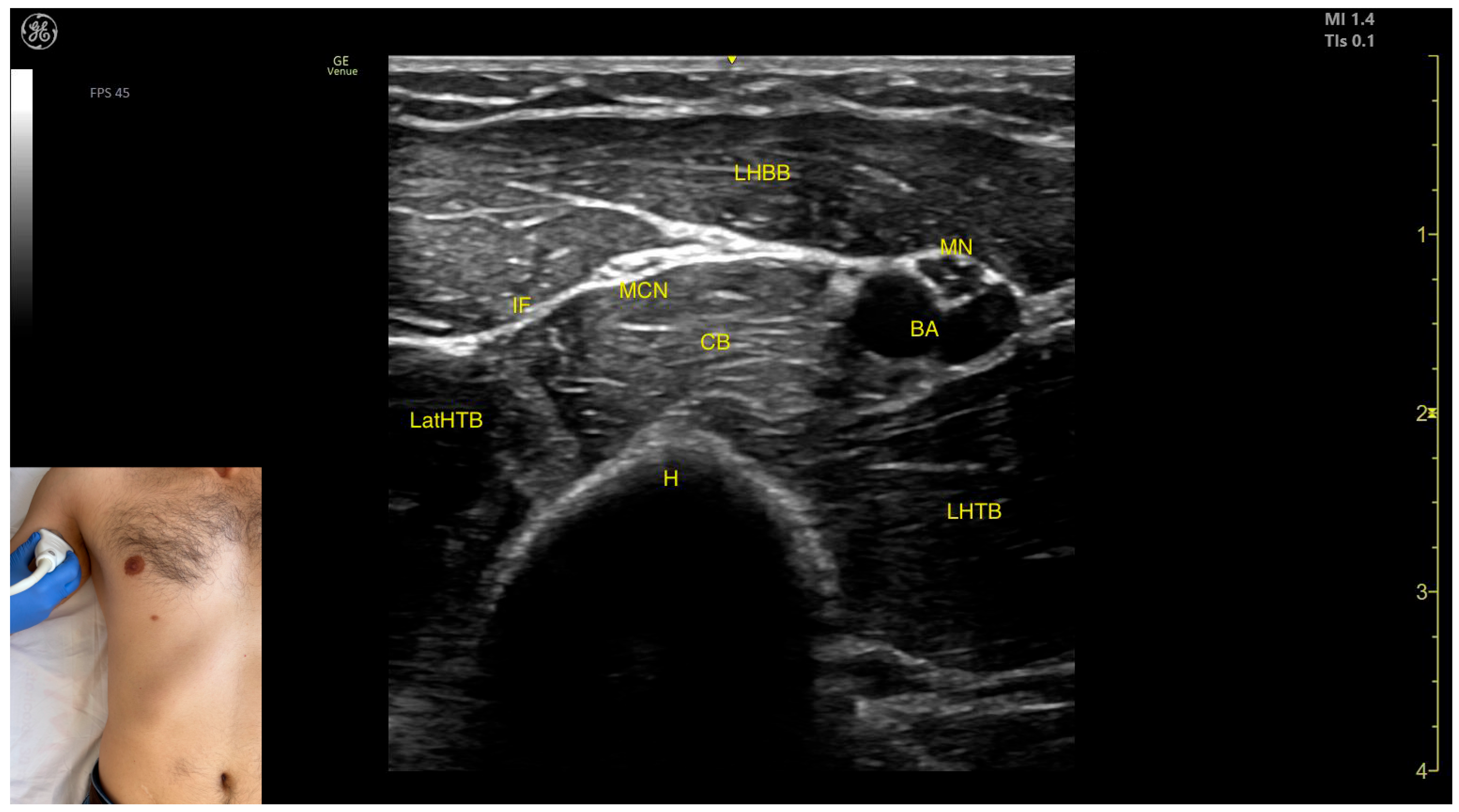 Toxins 17 00276 g013