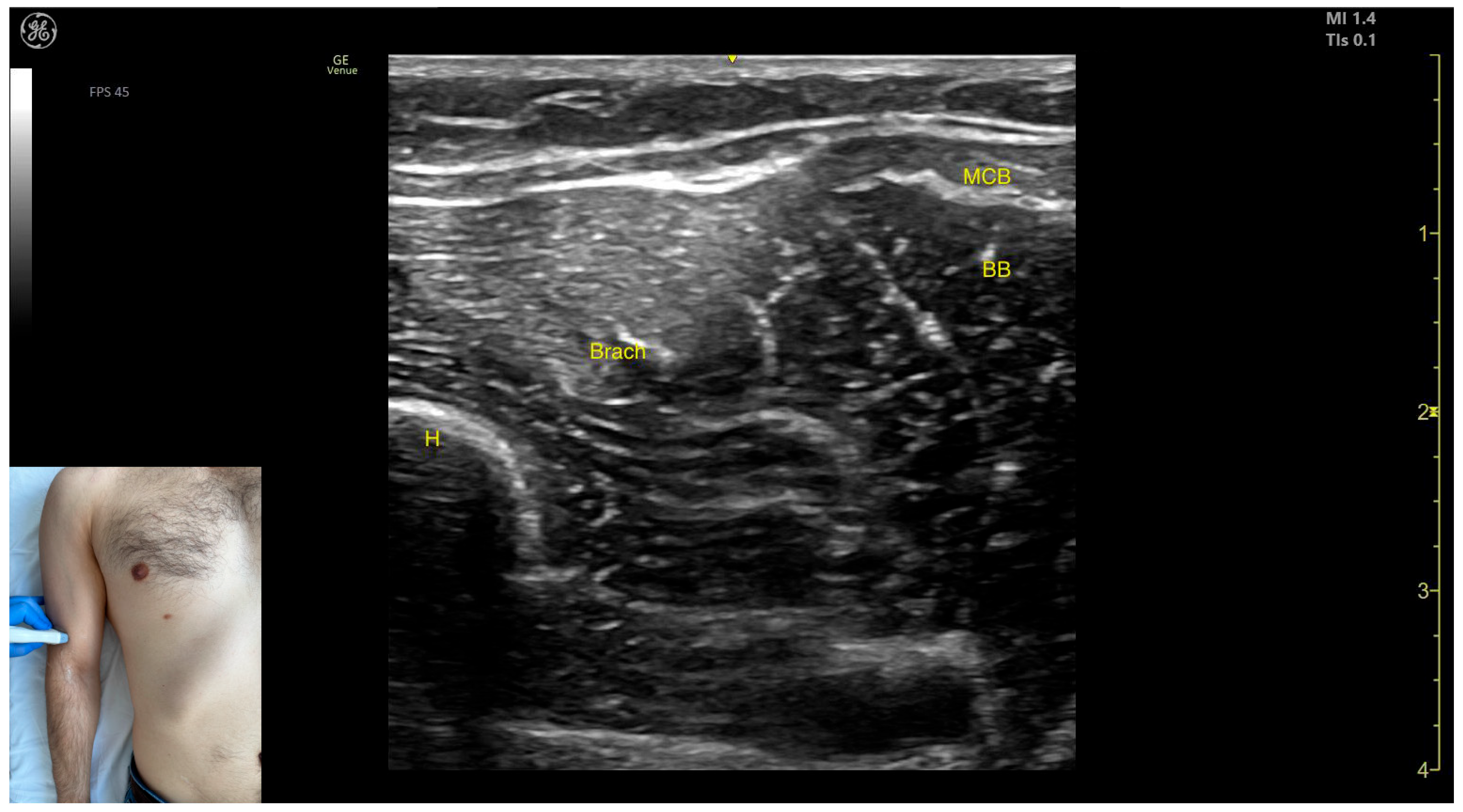 Toxins 17 00276 g014