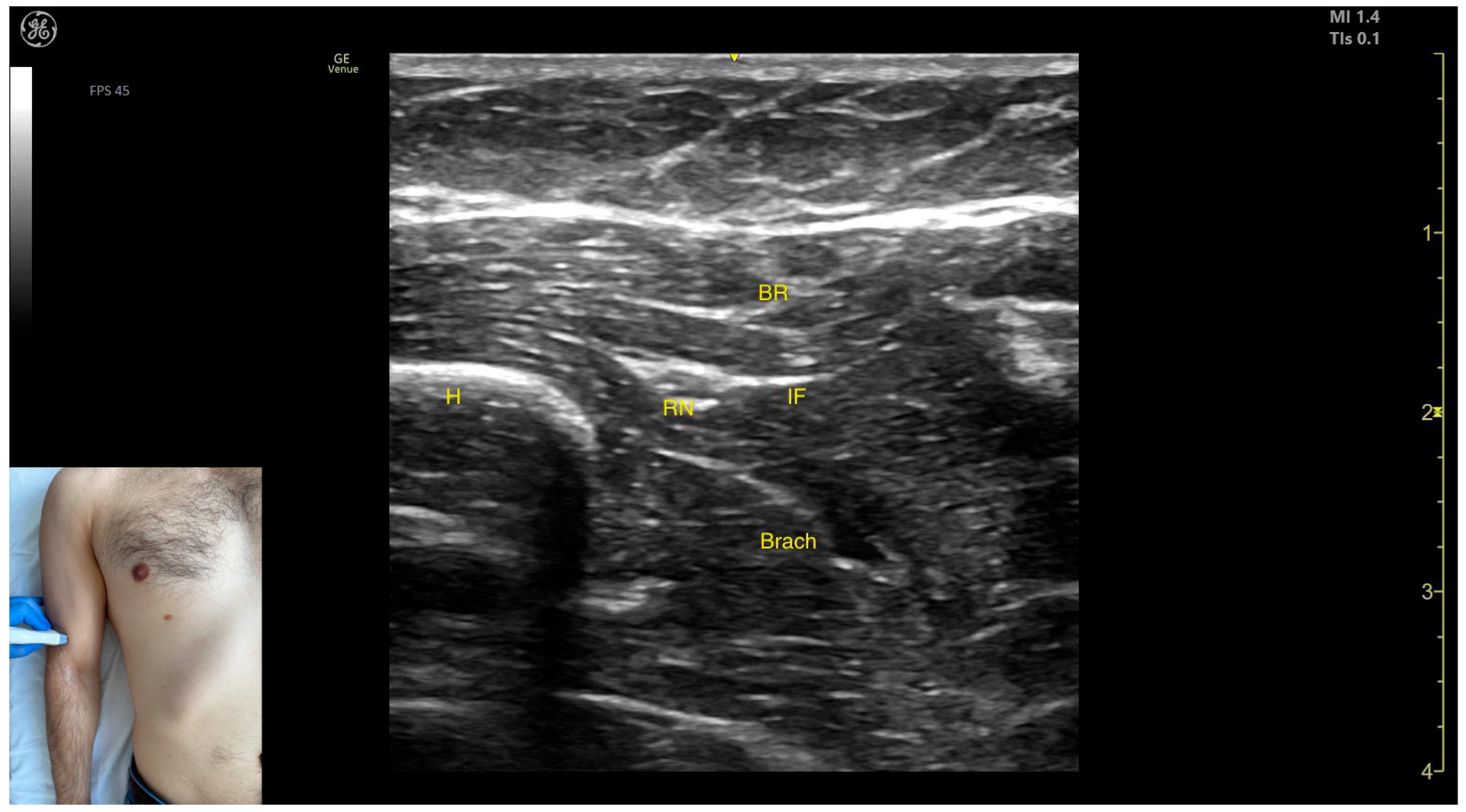 Toxins 17 00276 g015