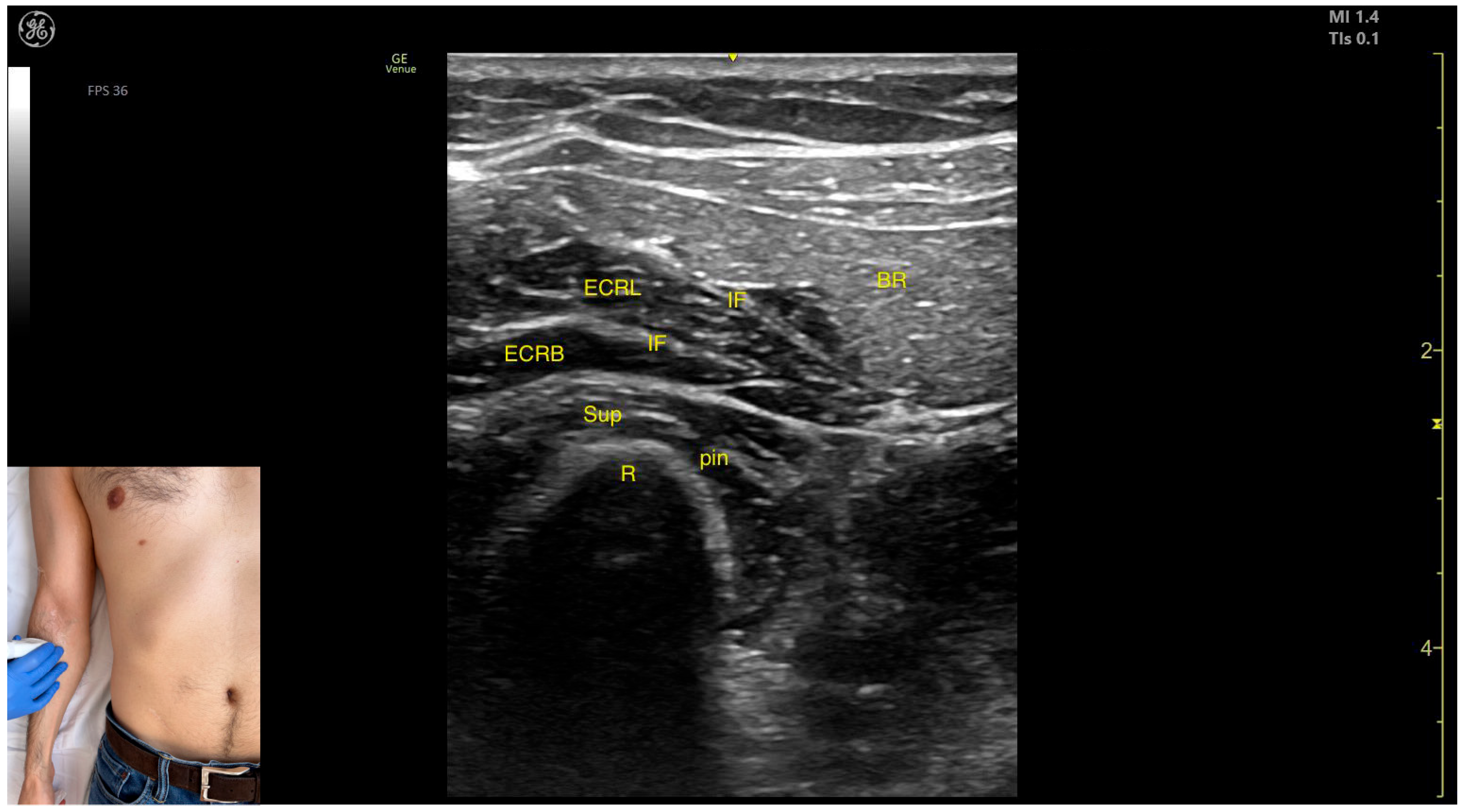 Toxins 17 00276 g016