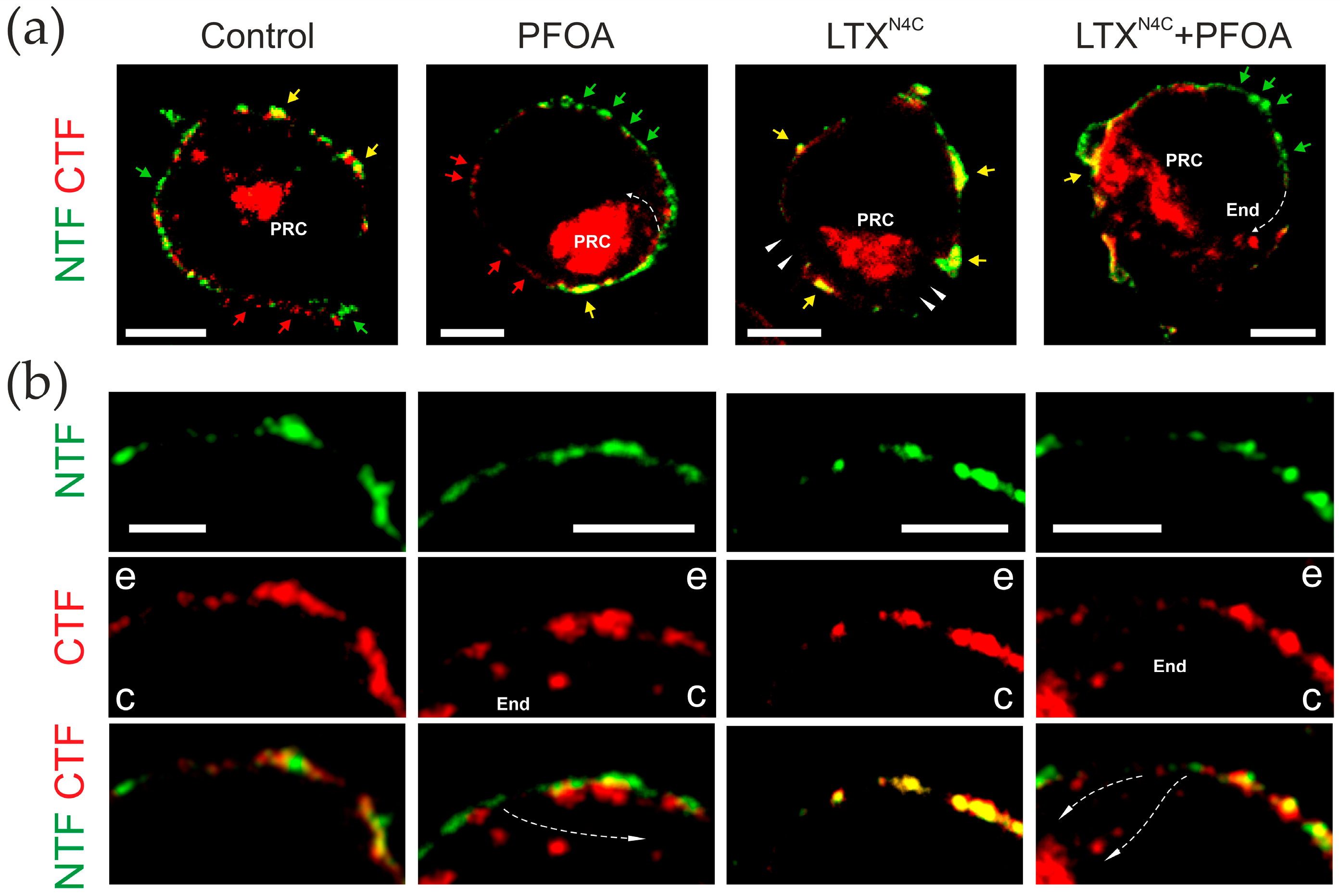 Toxins 17 00359 g005