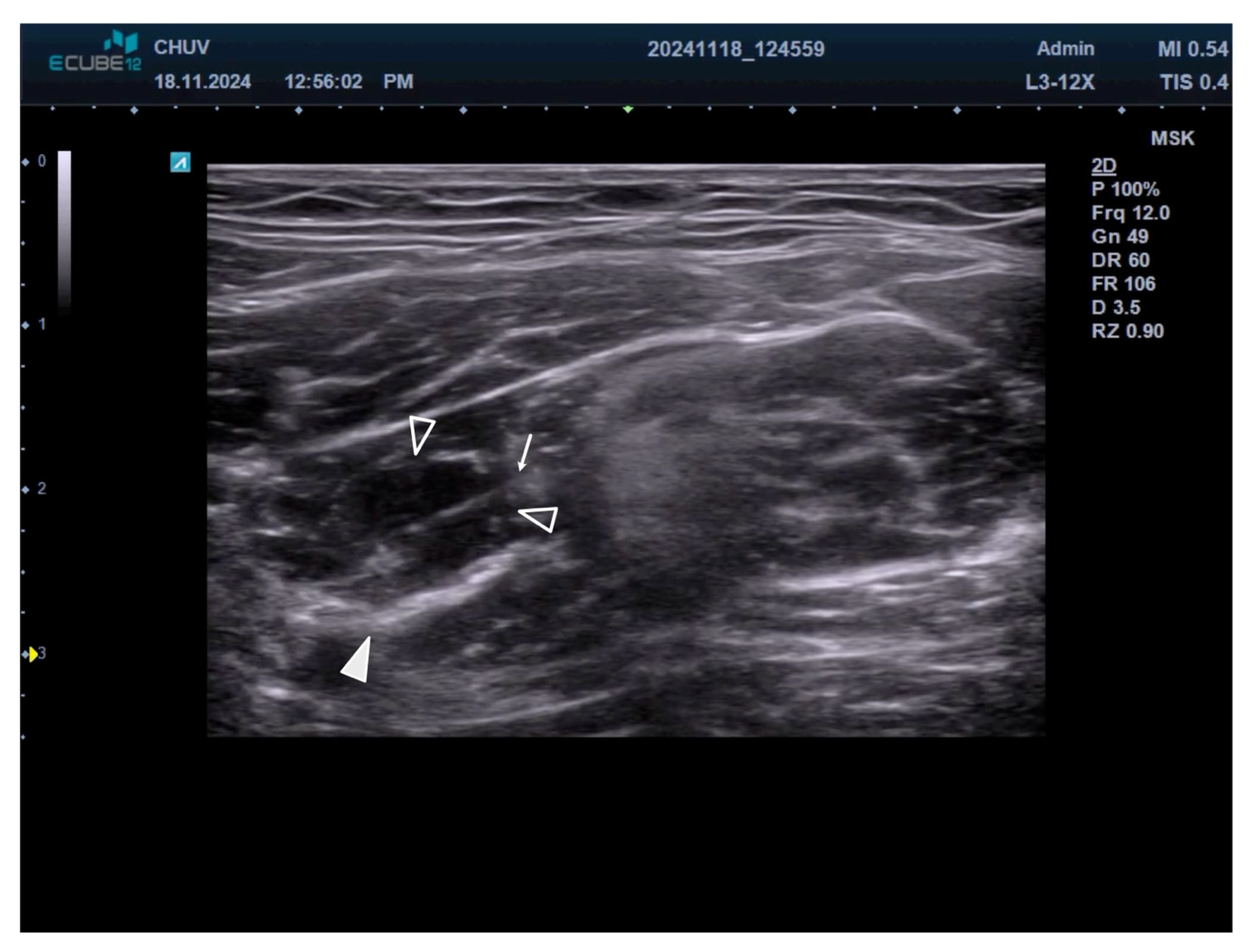 Toxins 17 00437 g003