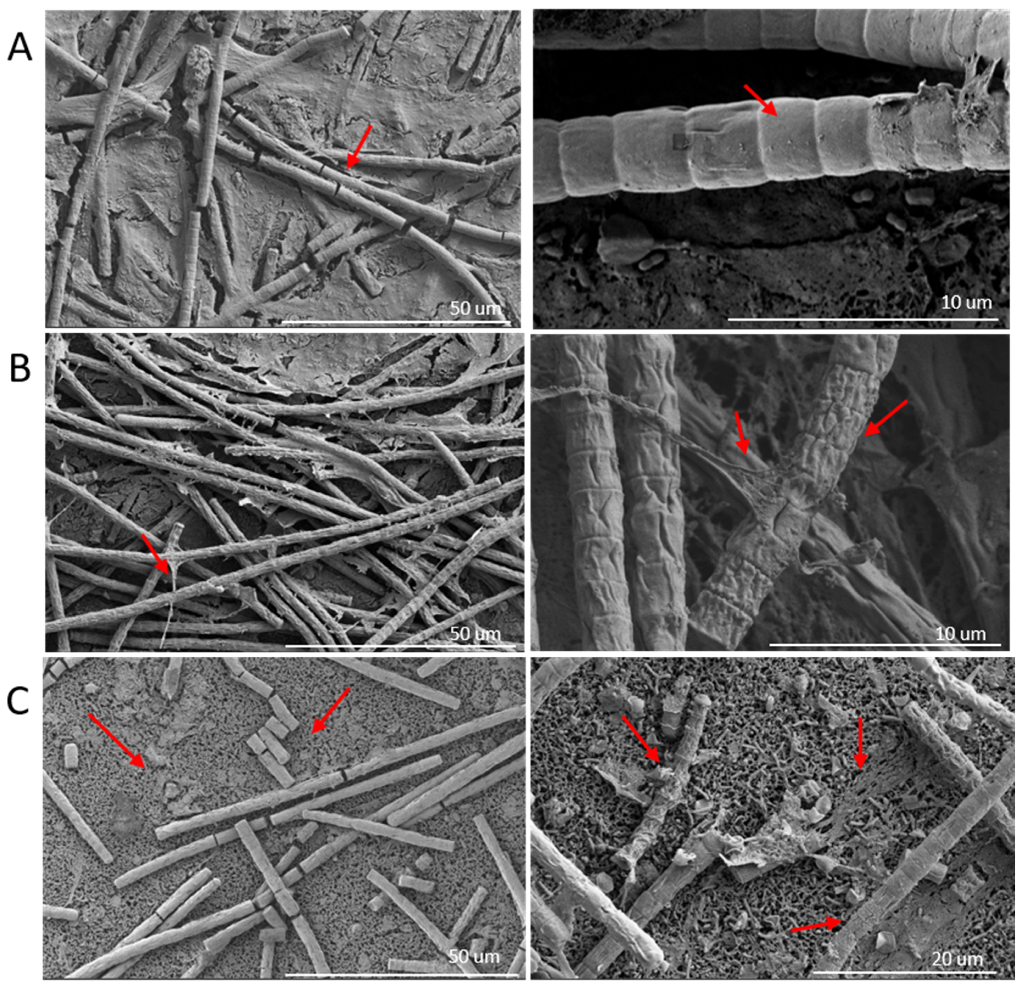 Toxins 17 00450 g004 Toxins 17 00450 g004