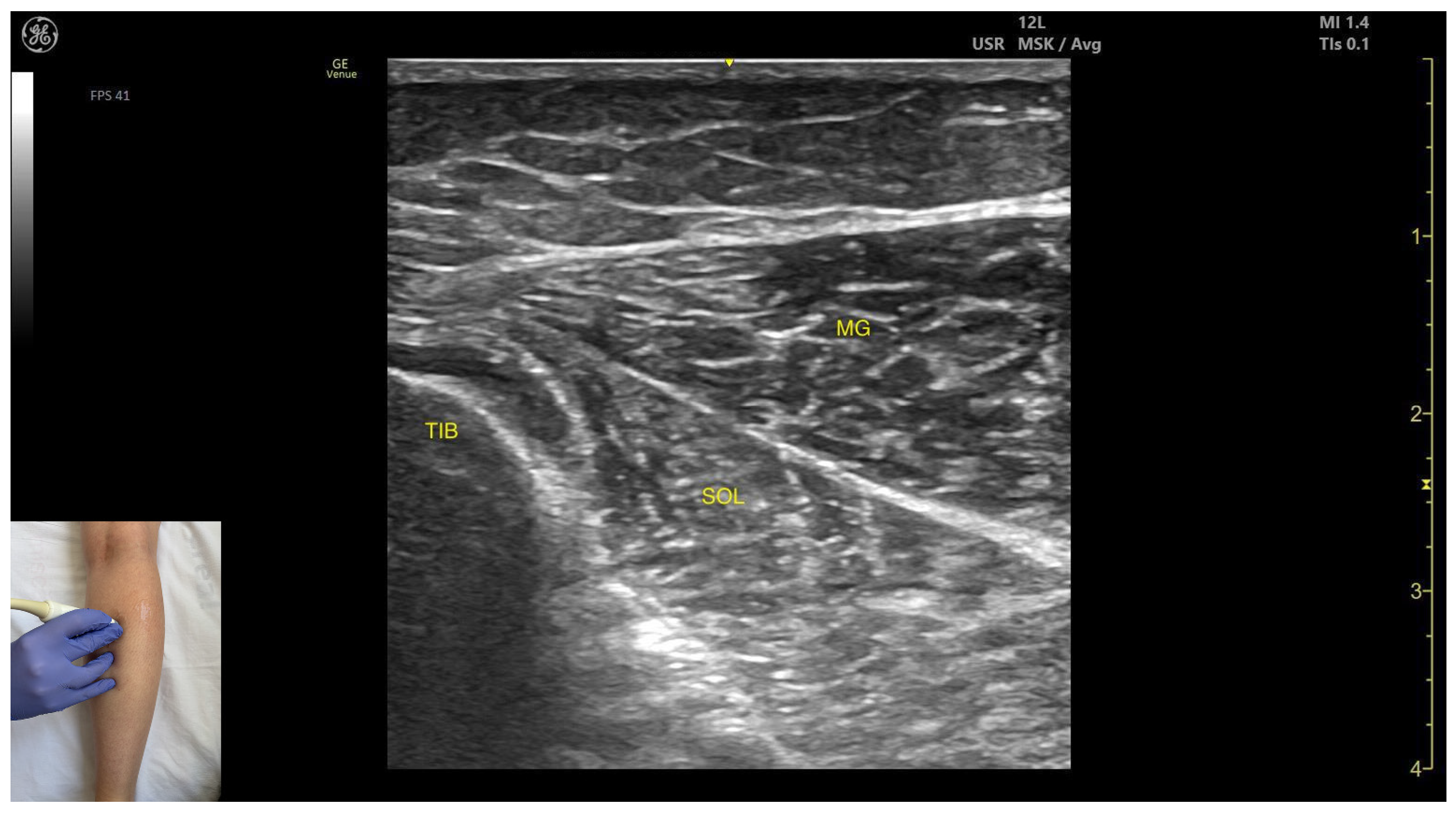 Toxins 17 00508 g002 Toxins 17 00508 g002