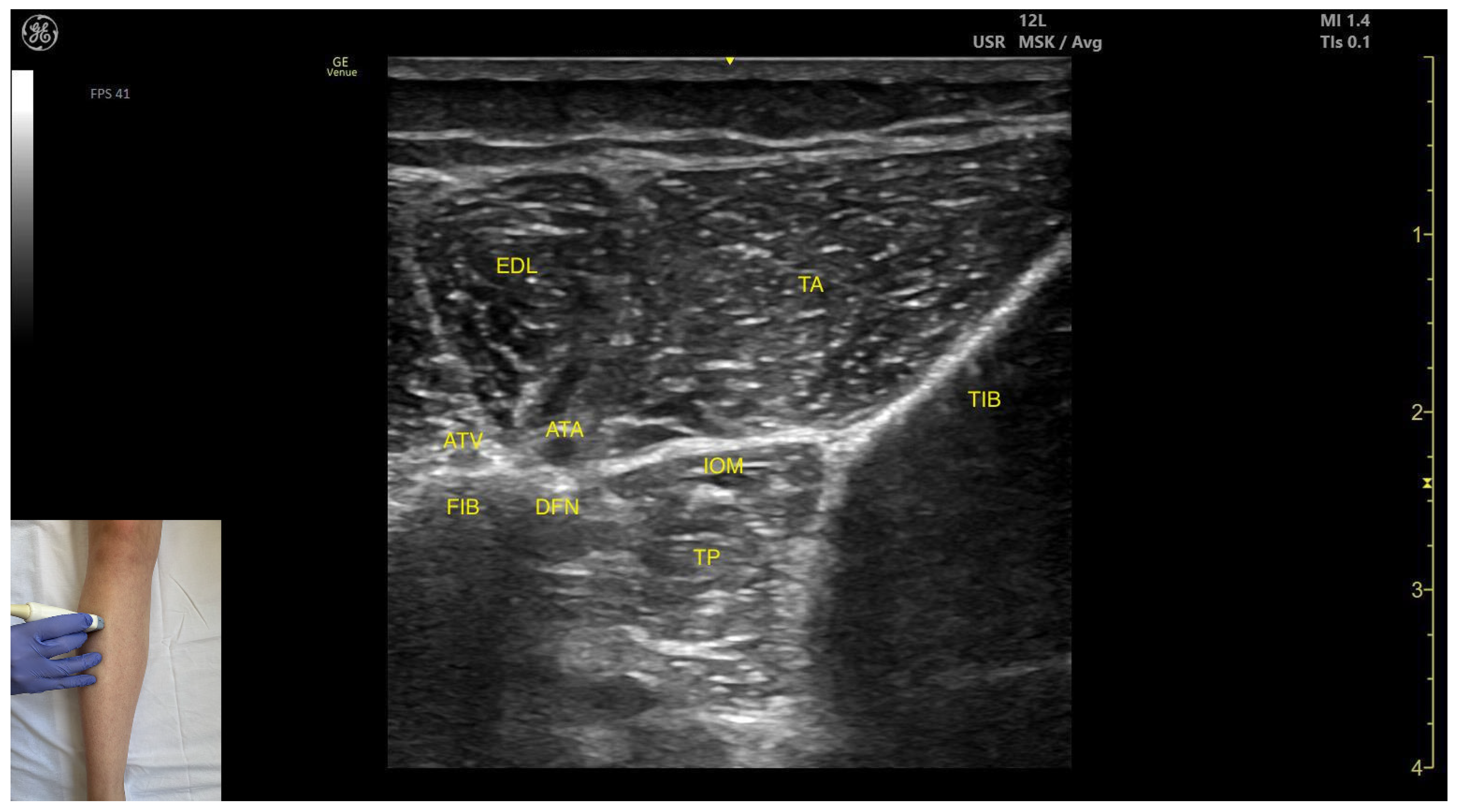 Toxins 17 00508 g004 Toxins 17 00508 g004