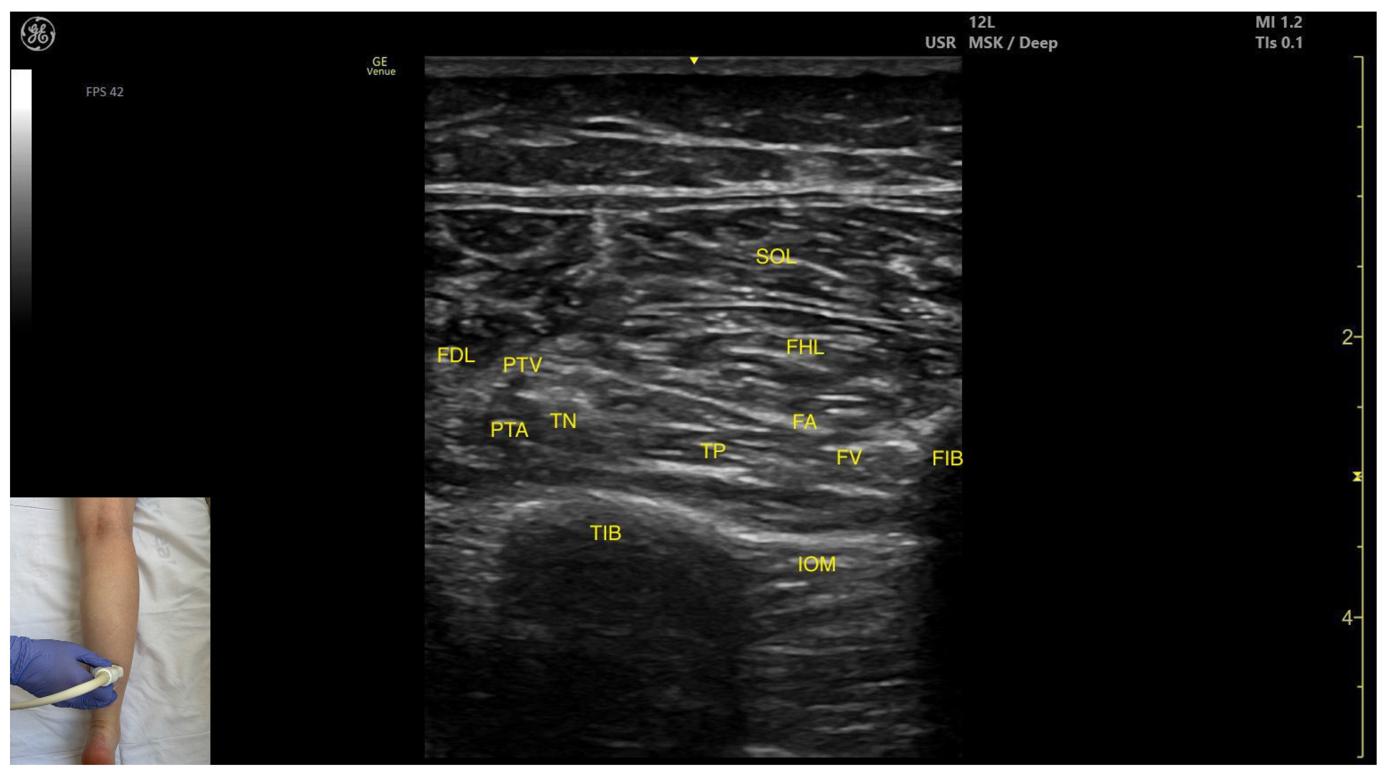 Toxins 17 00508 g006 Toxins 17 00508 g006