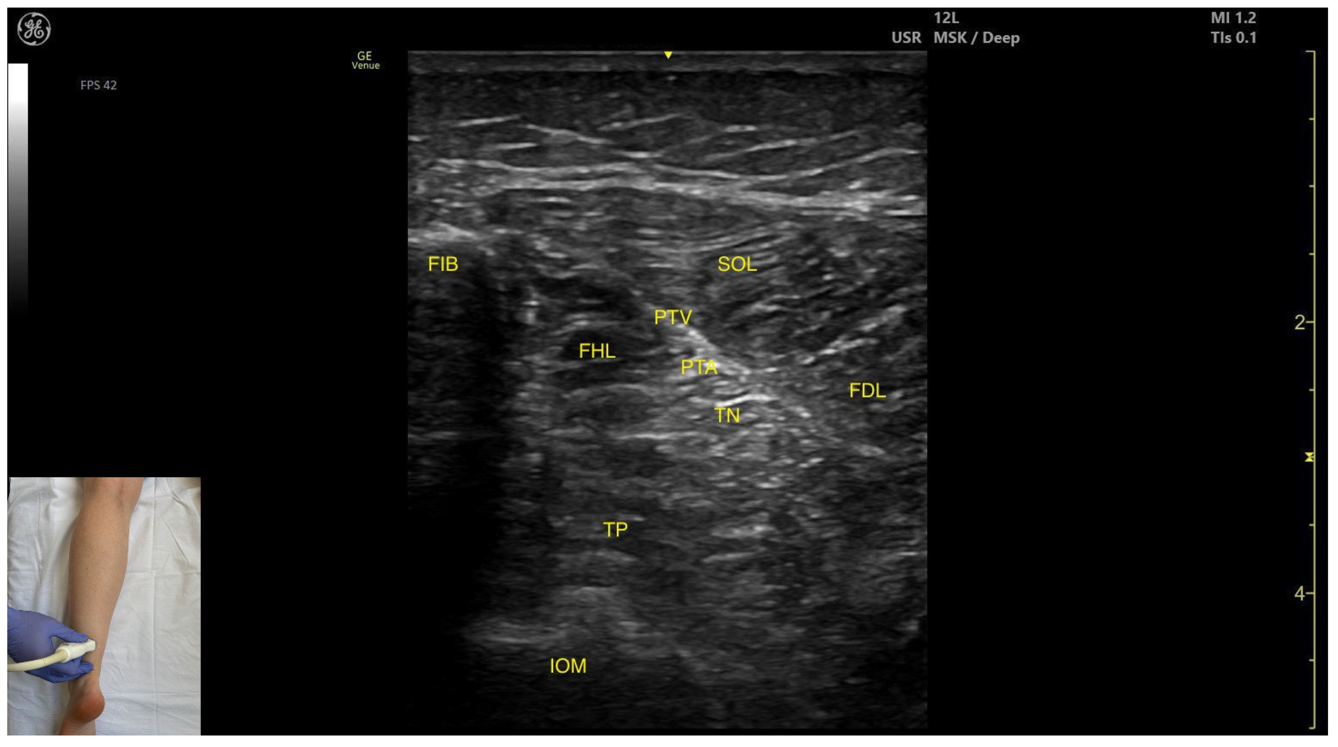 Toxins 17 00508 g007 Toxins 17 00508 g007